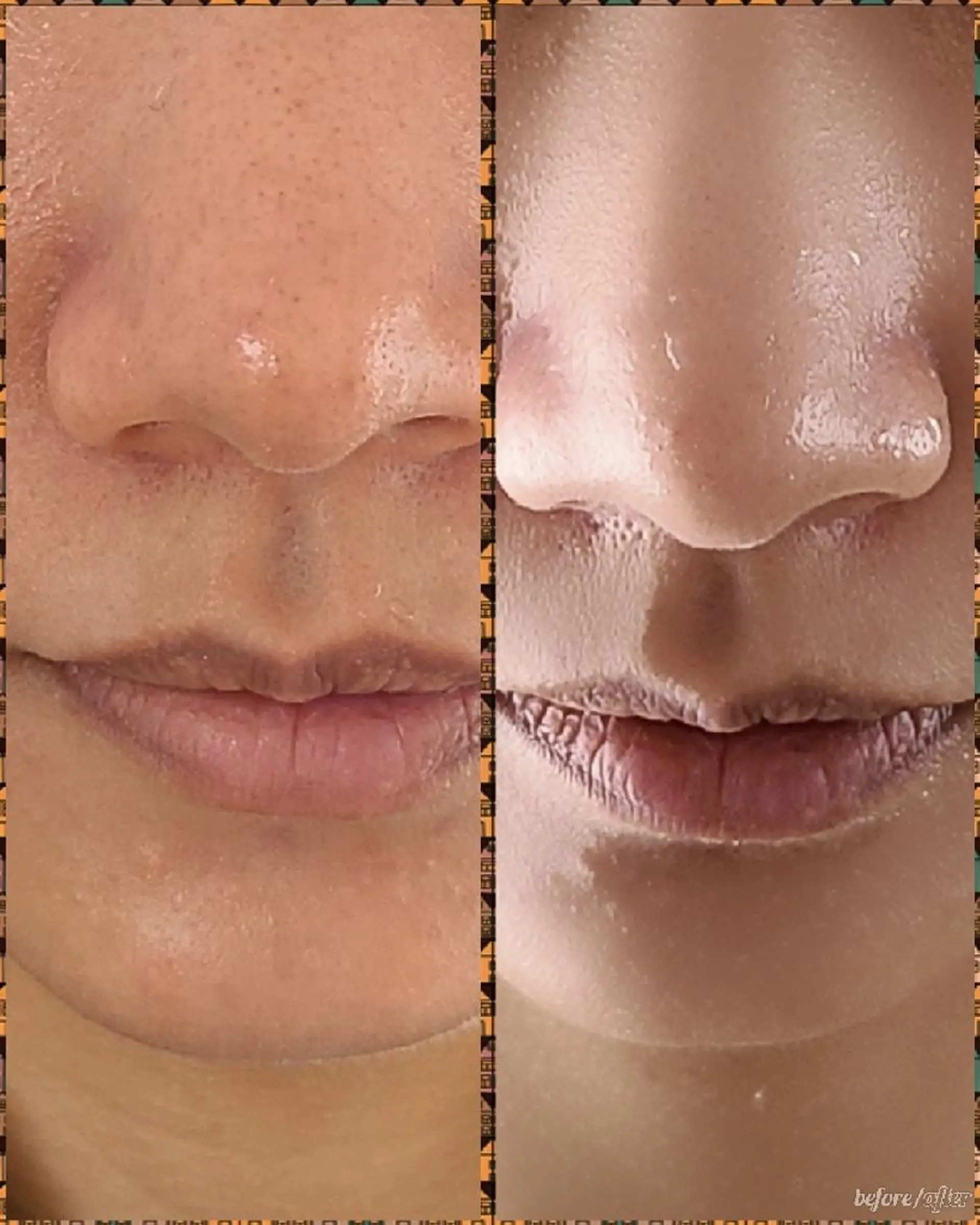 エステ 最新マシーン氣顔 REBORN幸田のエステ・リラクイメージ