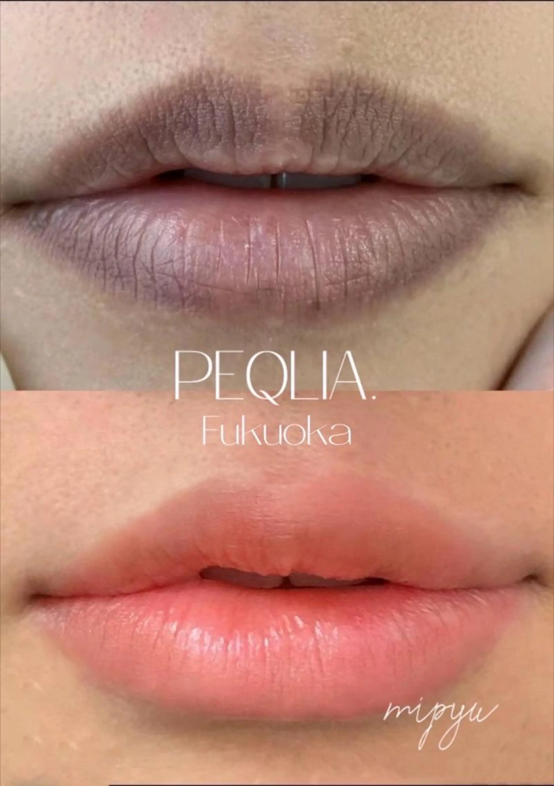 エステ 【フェムケア専門店】 PEQLIA福岡のエステ・リラクイメージ