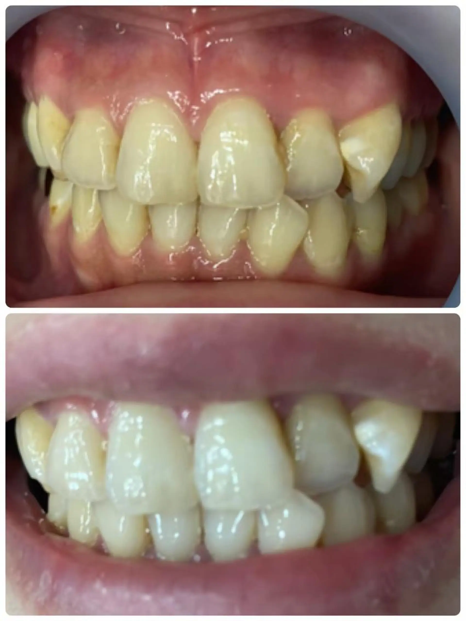 メンズ LOVEホワイト ニング恵比寿店のその他イメージ