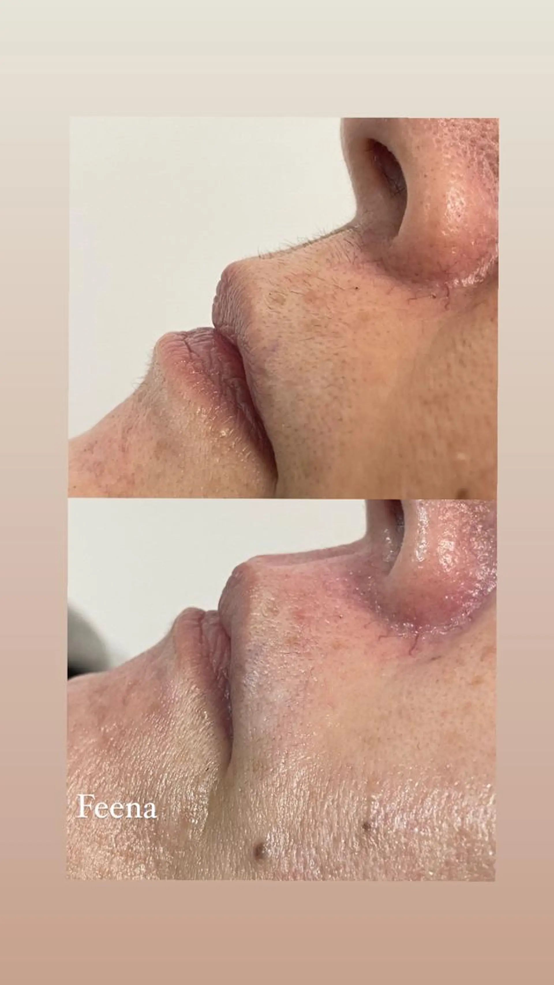 amu nail. RINAのネイルデザイン