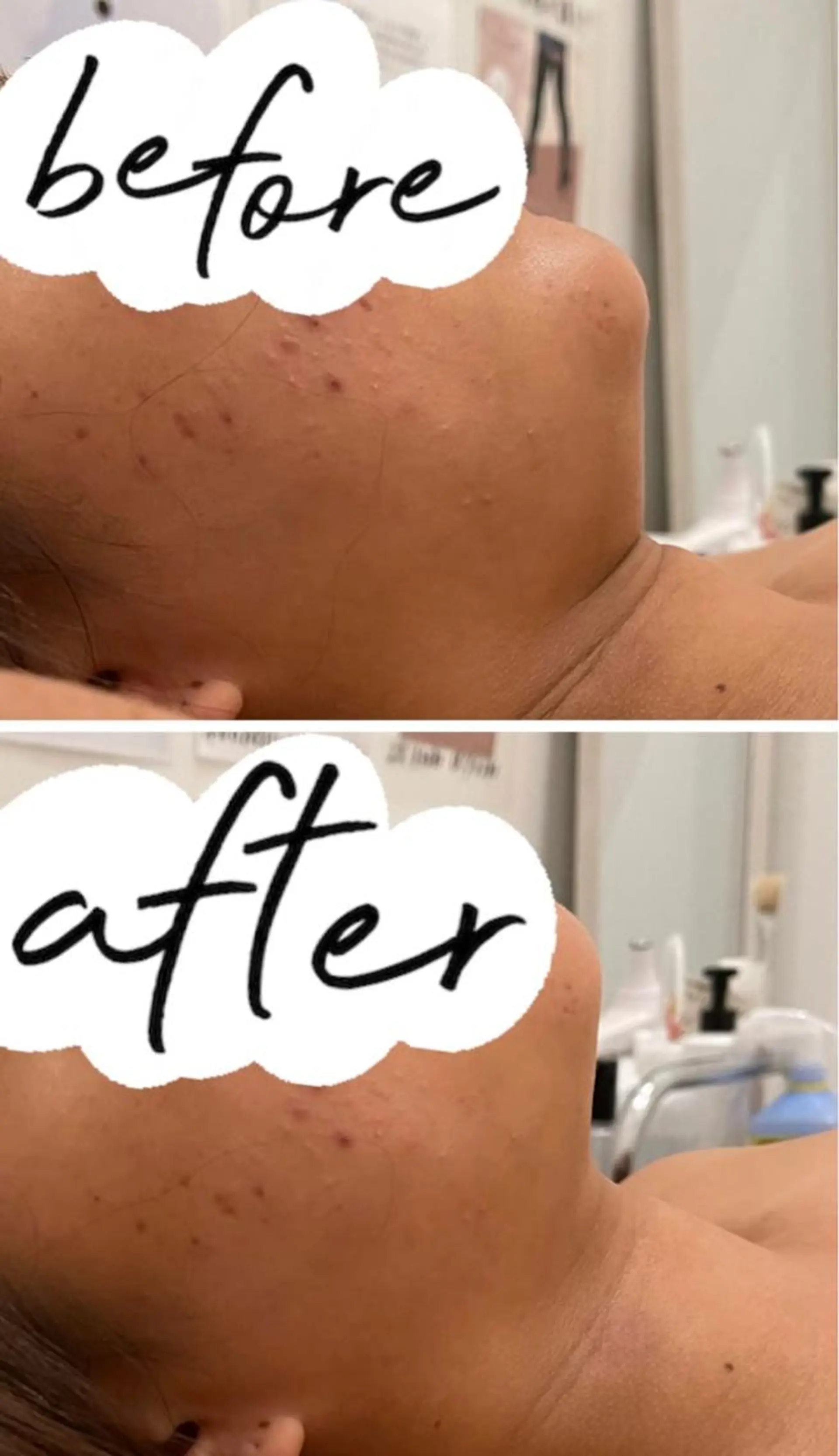 エステ VOIR東静岡店所属・竹内 彩香のエステ・リラクイメージ