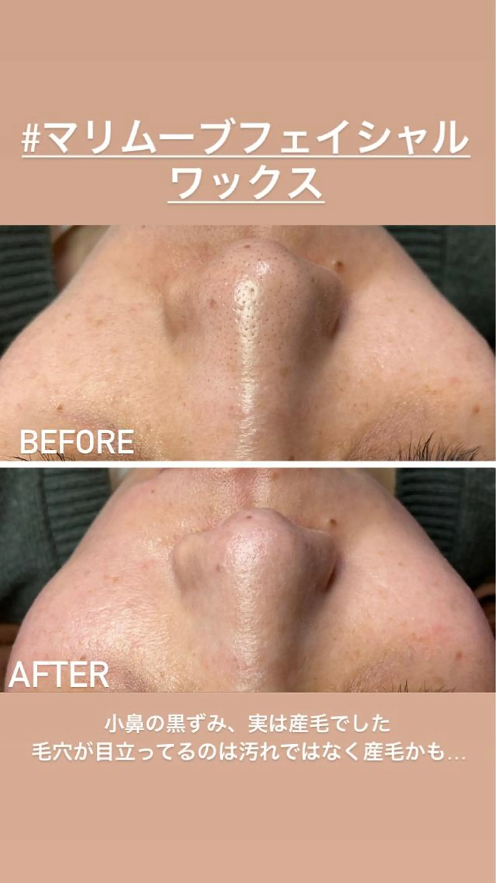 美顔秘密基地新宮所属・美顔秘密基地 新宮のその他イメージ