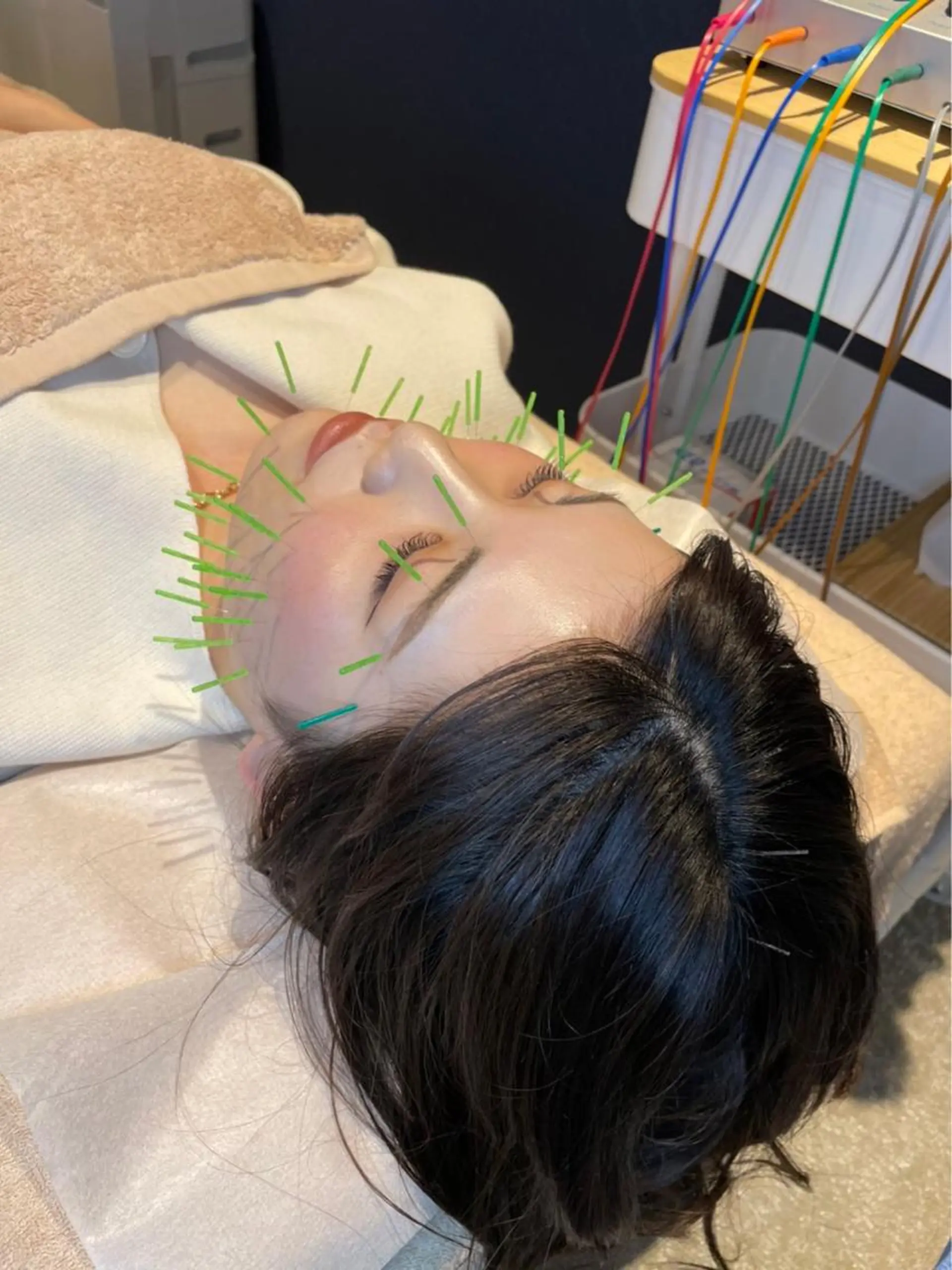 メンズ 美容鍼灸サロンulu所属・美容鍼灸サロン ulu【博多祇園】のエステ・リラクイメージ