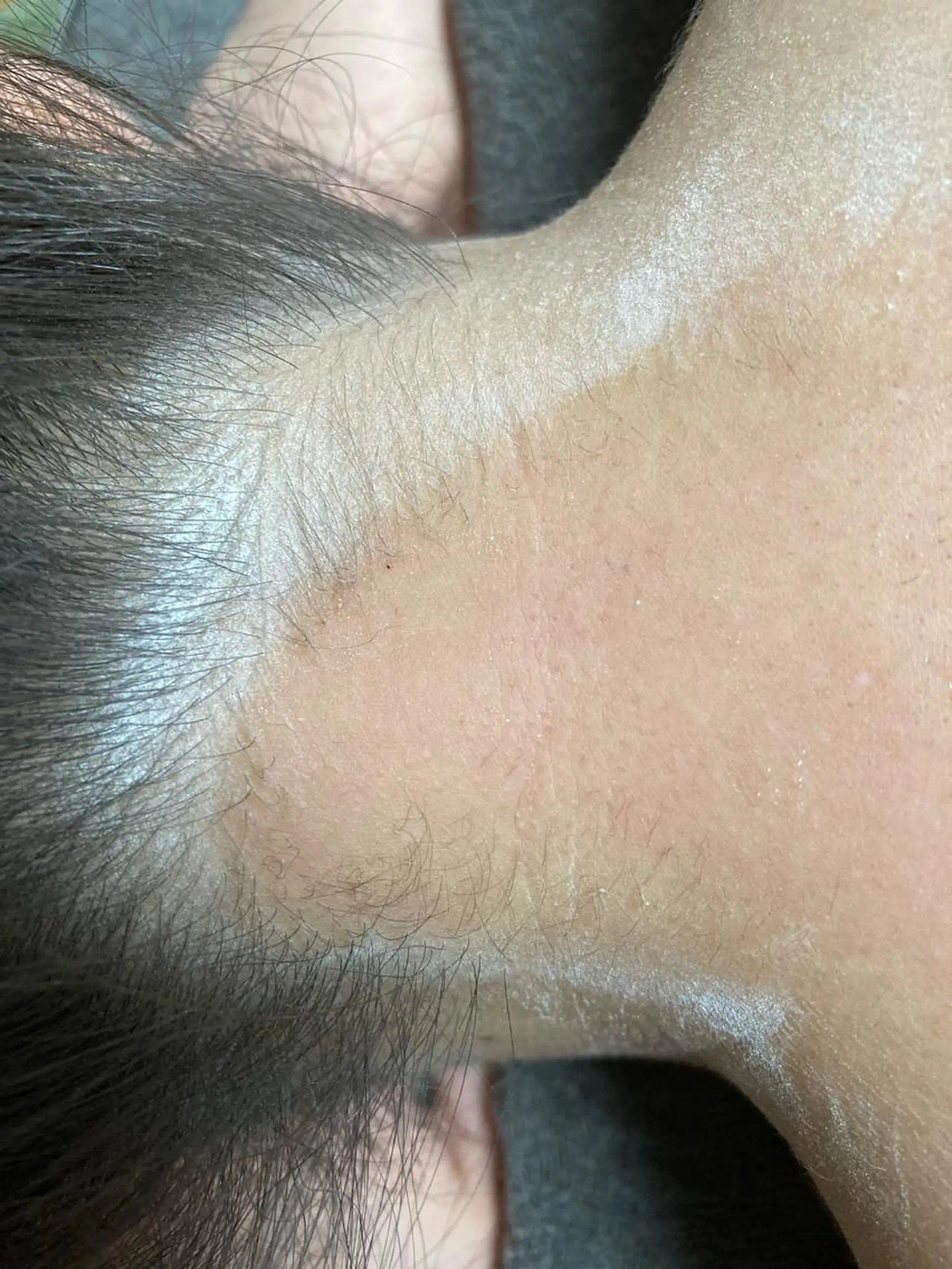 脱毛 Ohata Megumiの眉毛・アイブロウイメージ