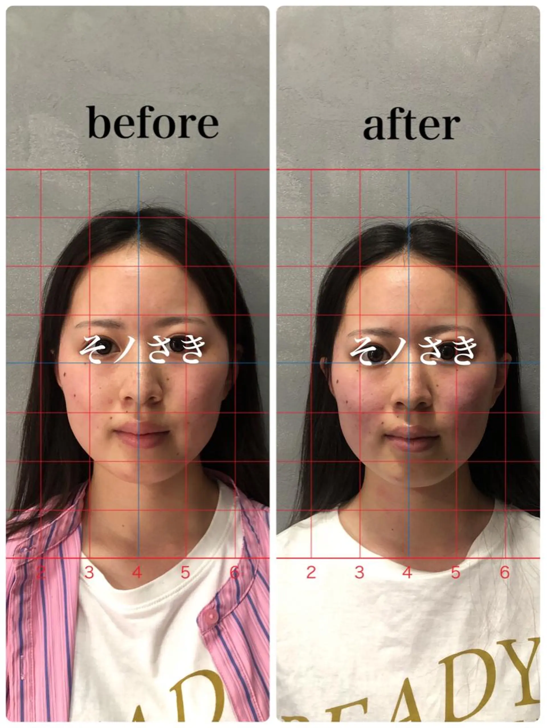 そノさき所属・大阪のシーサー🦁 島袋のエステ・リラクイメージ