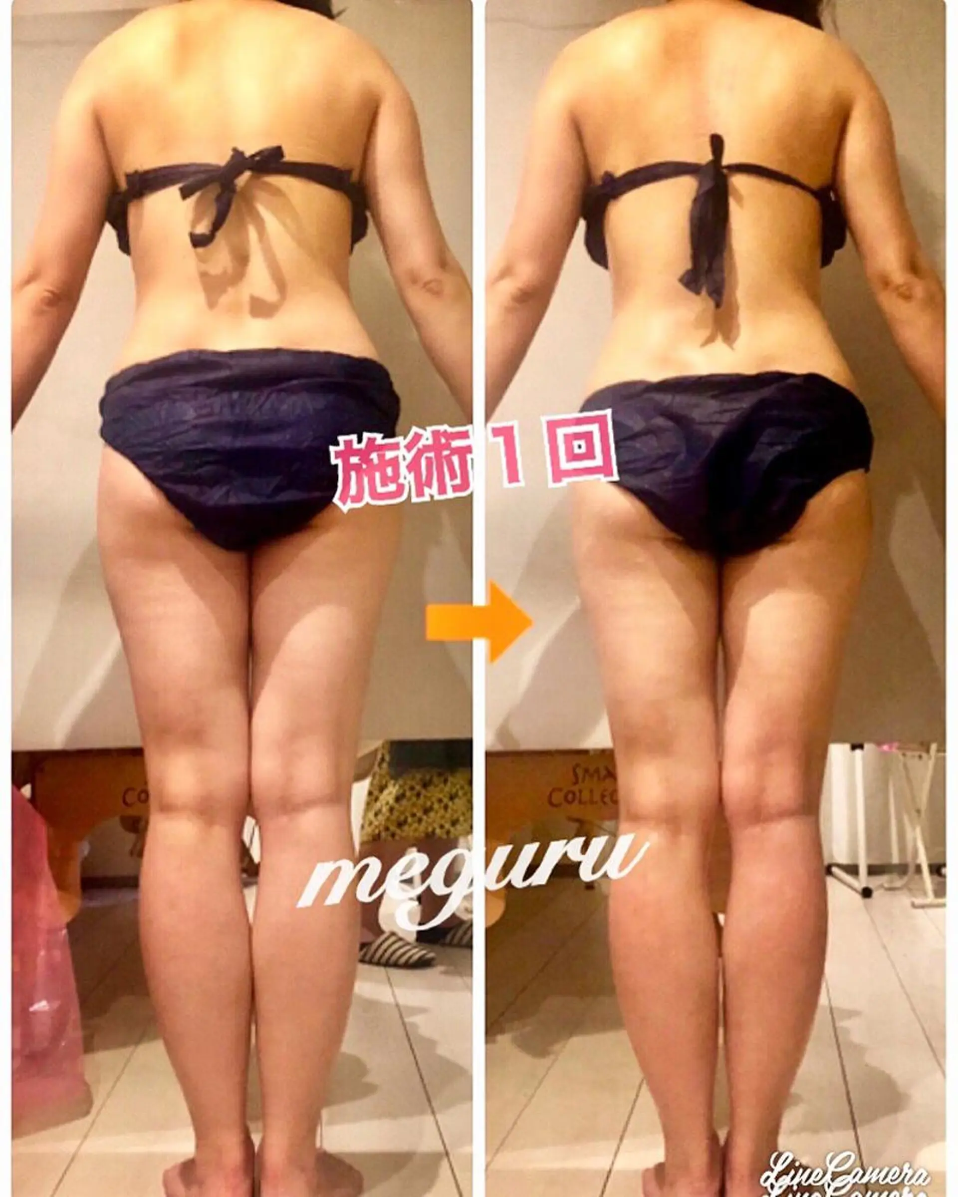 ショート カラー パーマ ヘアアレンジ メンズ キッズ ネイル マツエク・マツパ トリートメント 赤色 ‍痩身＆ボディ 結果出し🌟丹野のエステ・リラクイメージ