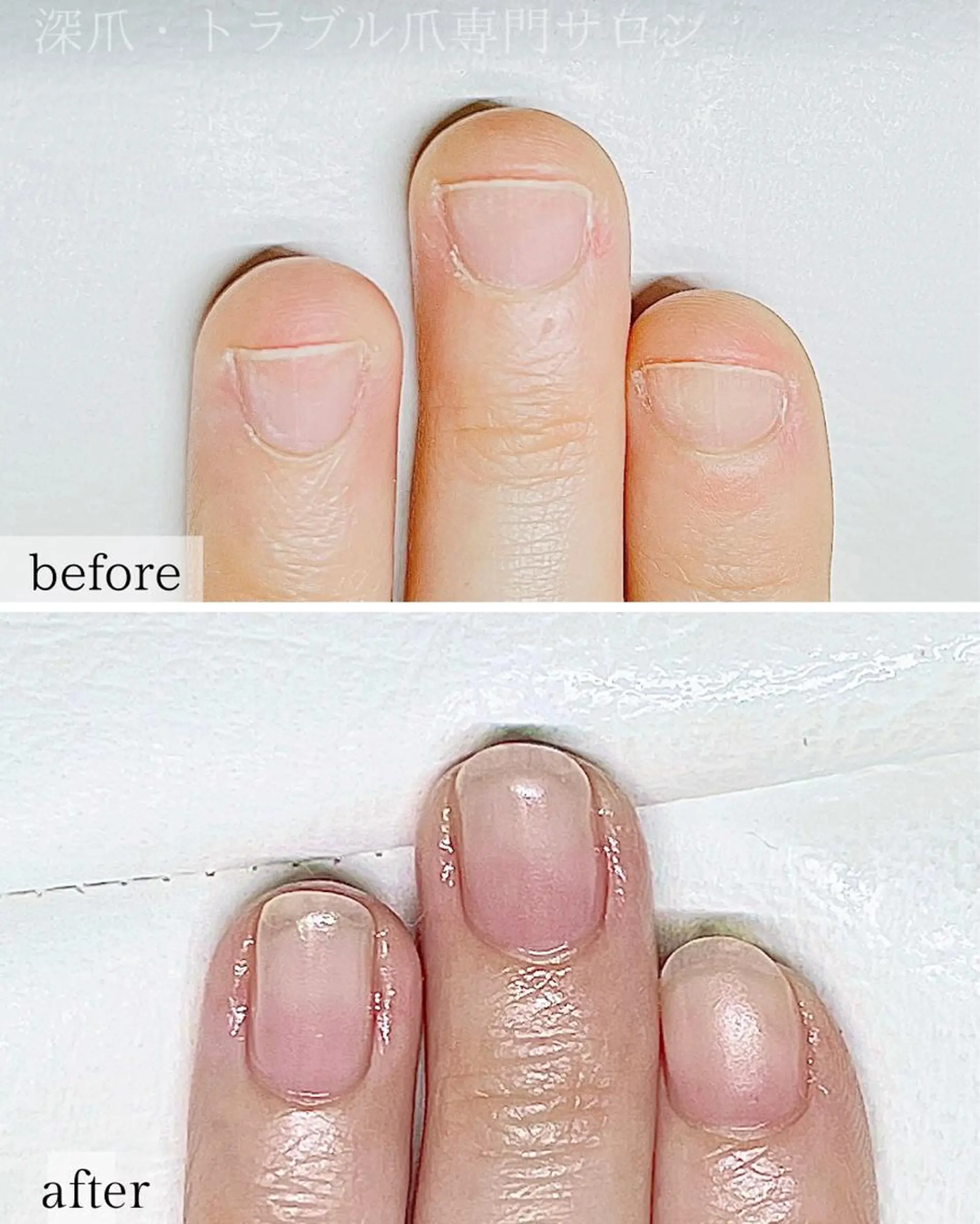 ネイル 成人式 ハンドネイル ハンドケア 深爪・巻き爪 専門サンセリテのネイルデザイン