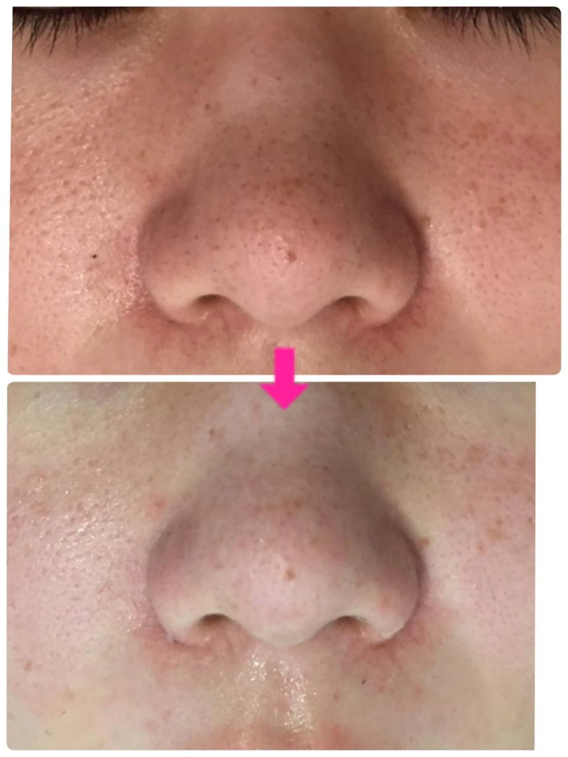 ショート カラー パーマ ヘアアレンジ メンズ キッズ ネイル マツエク・マツパ 赤色 ‍痩身＆ボディ 結果出し🌟丹野のエステ・リラクイメージ