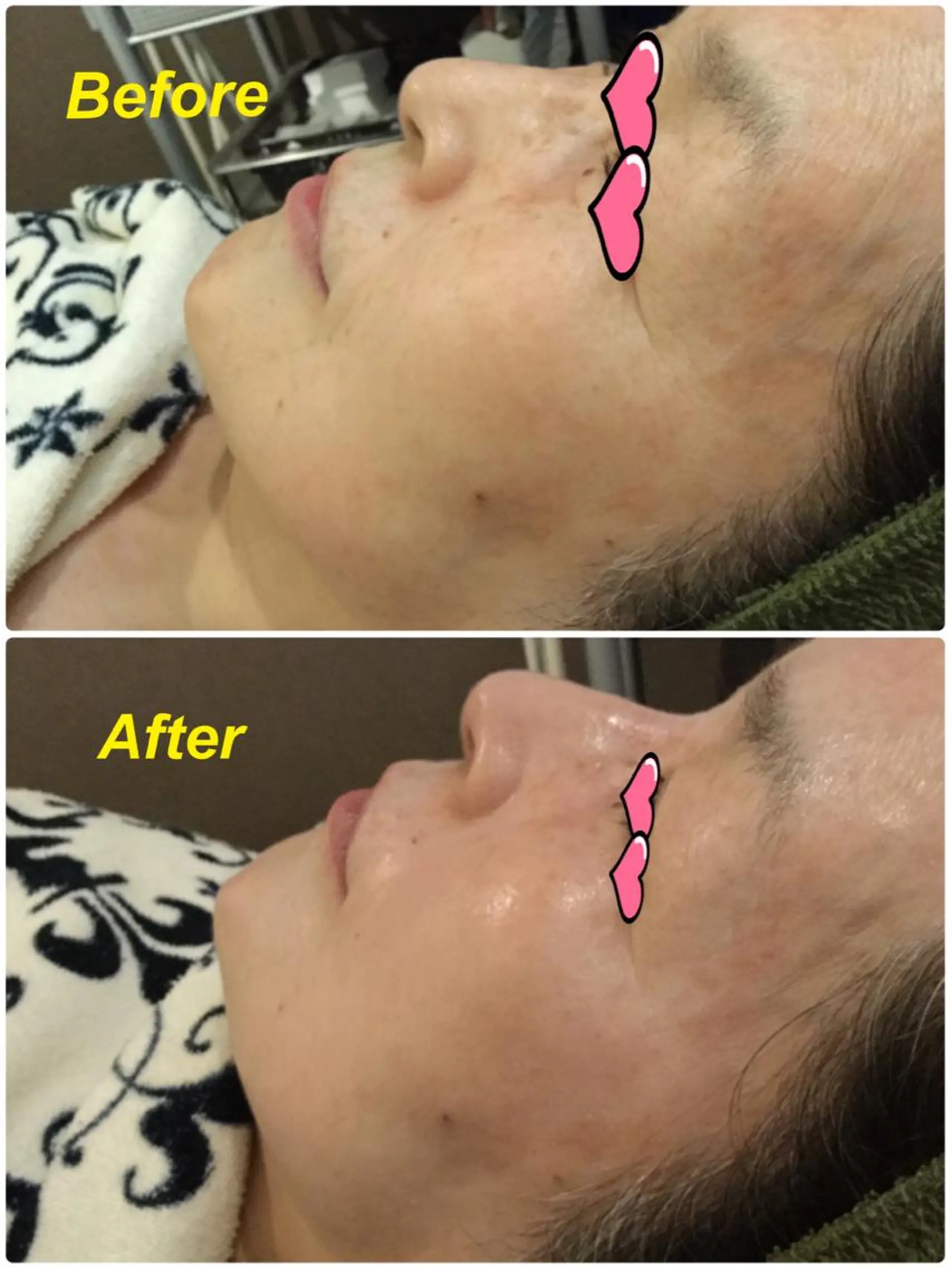 エステ 【リベルハーブピーリング認定店】敏感肌・美白脱毛専門店Dione立川店所属・Dione 立川店のエステ・リラクイメージ