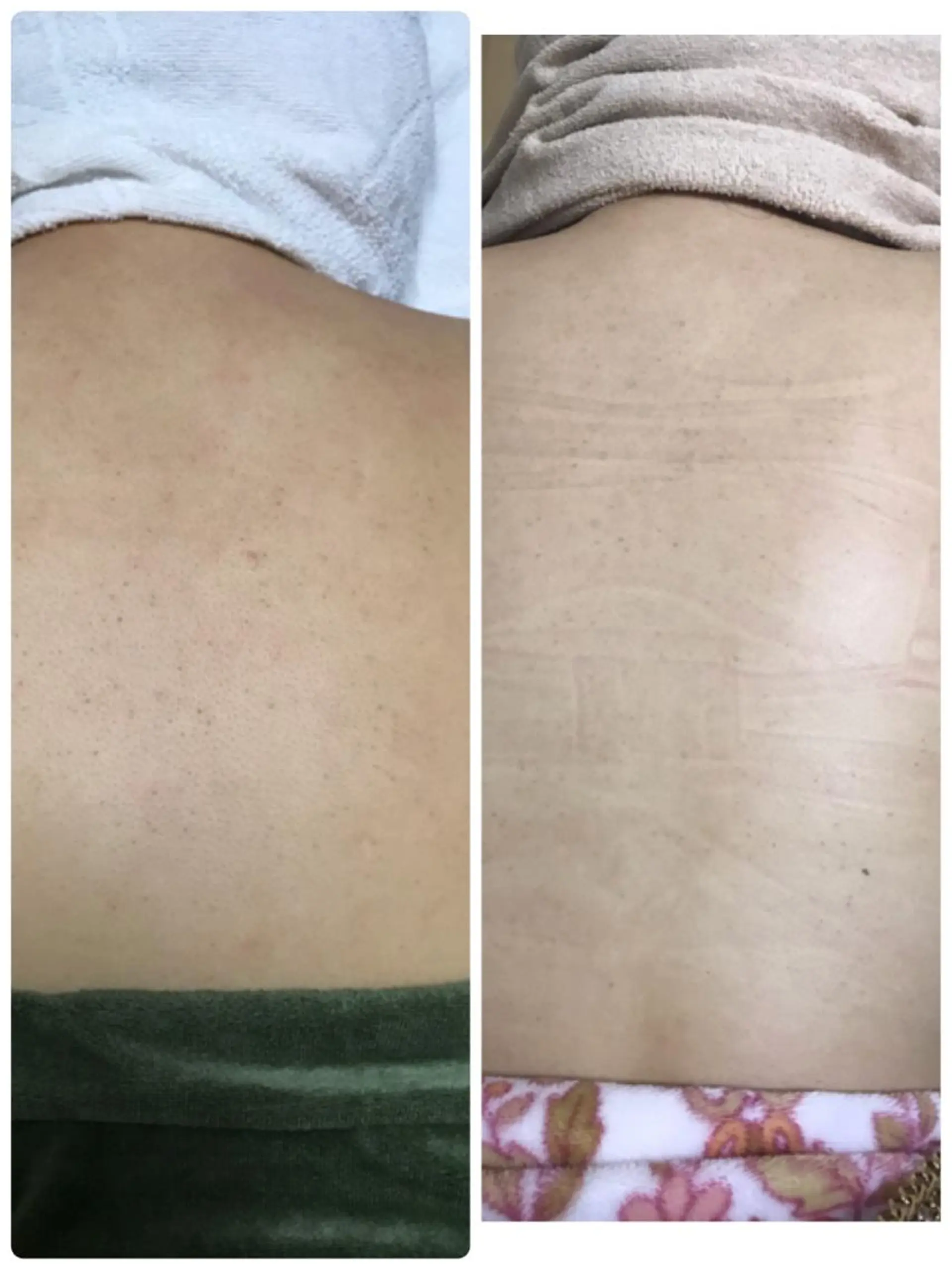 トータルエステサロン Tiaraのエステ・リラクイメージ