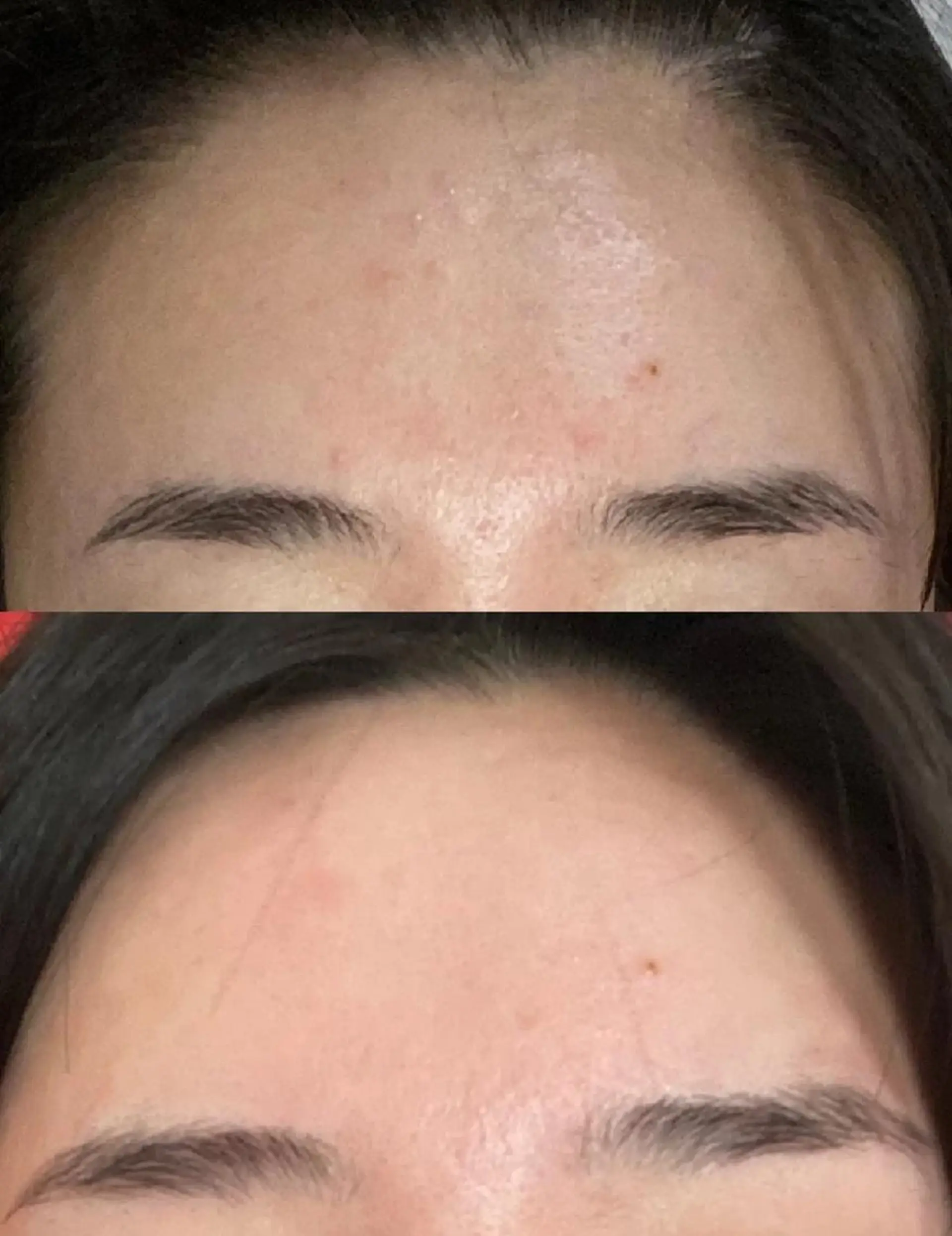 エステ aliaハイフ&水光ジェットサロン所属・aliaハーブ水光店 エステティシャン募集のエステ・リラクイメージ