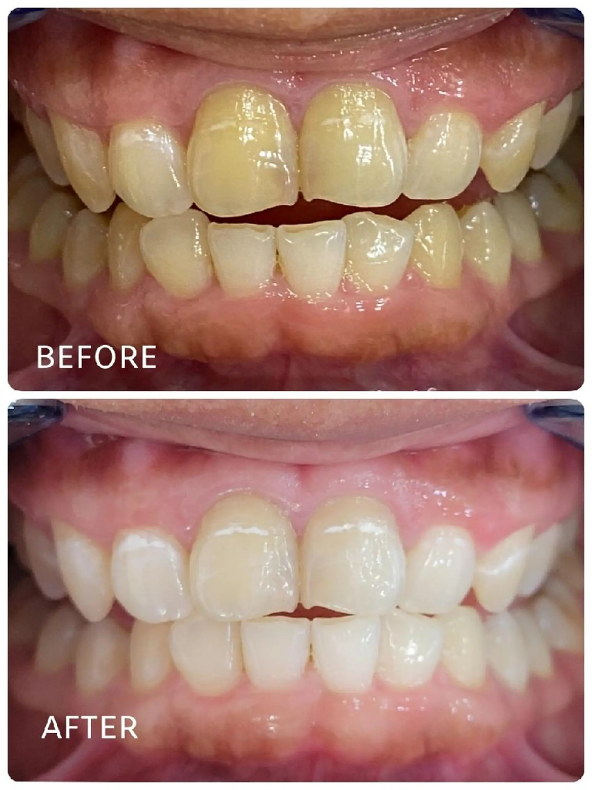 ホワイトニングサロン ラウレアのその他イメージ