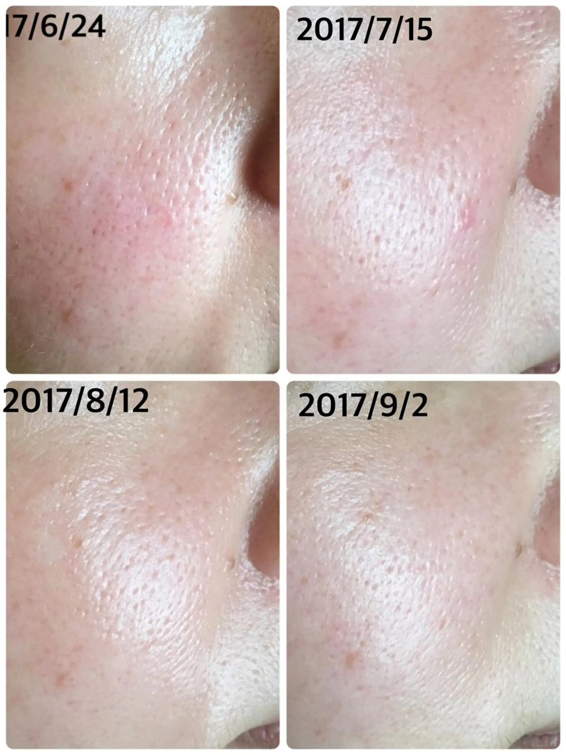 メナードフェイシャルサロン西区天塚所属・平岩 仁美のエステ・リラクイメージ