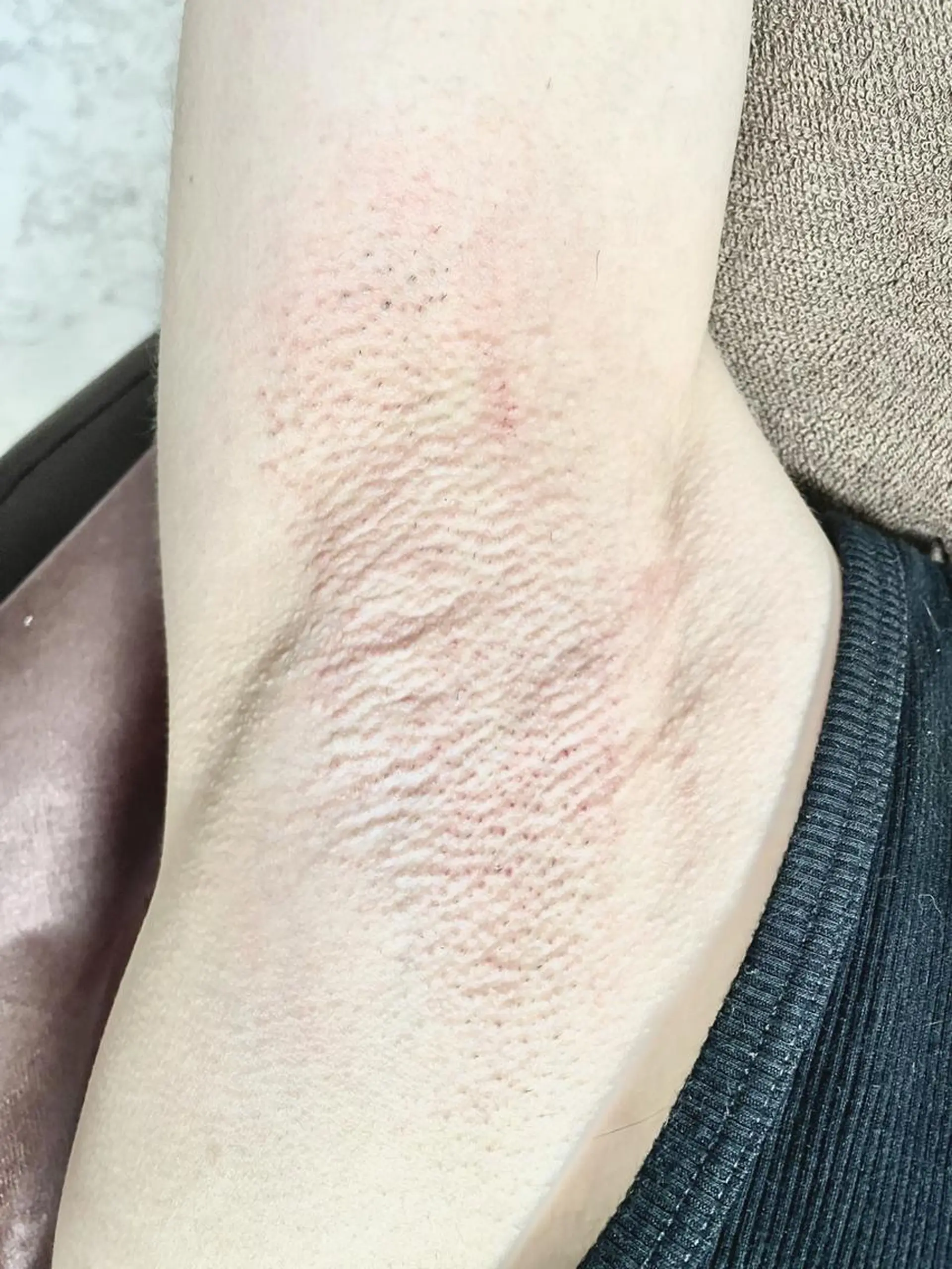 メンズ 脱毛 Epina 千葉店 【エピナ】のエステ・リラクイメージ