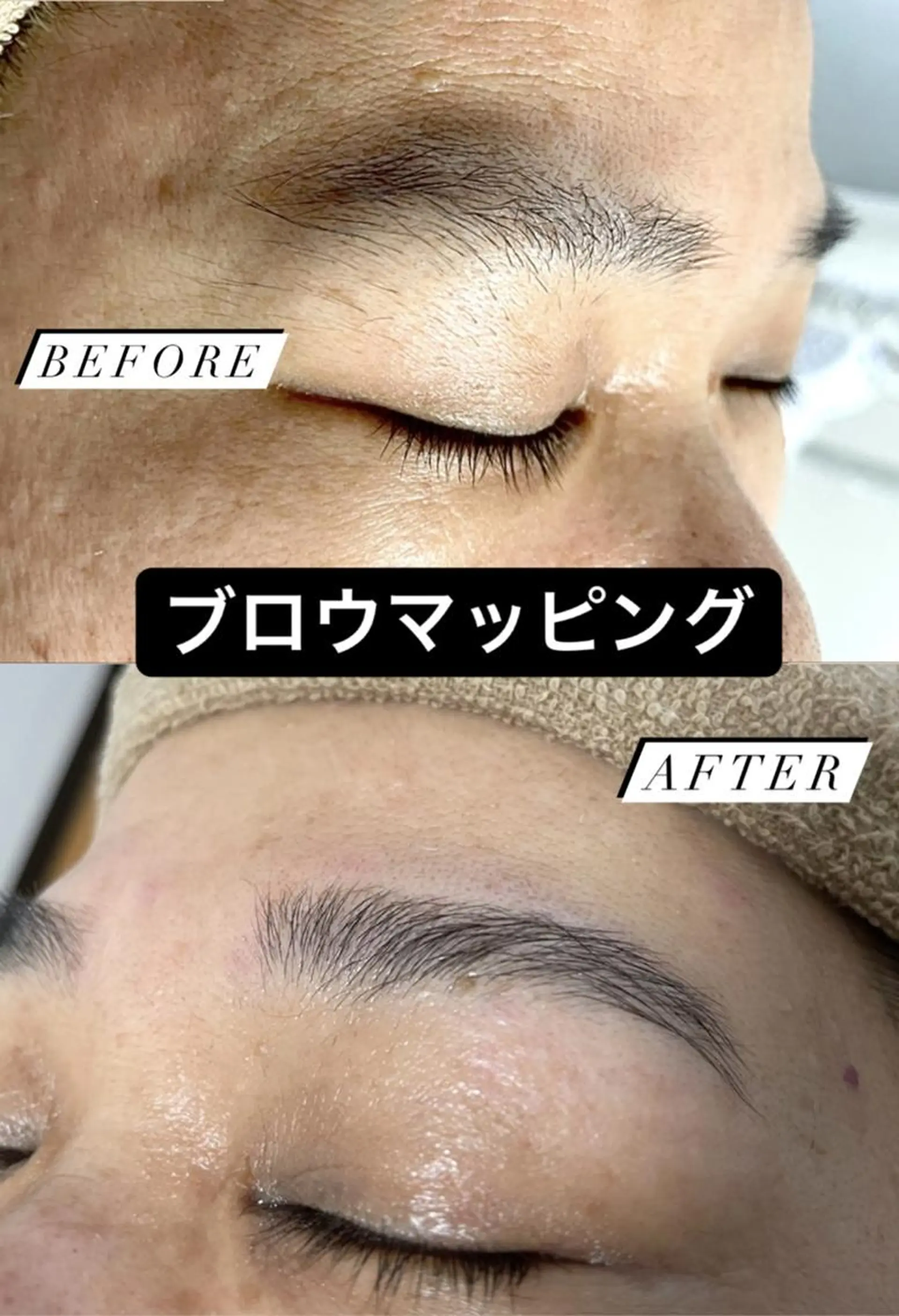 メンズ キッズ ワックス脱毛 Epina 千葉店 【エピナ】のエステ・リラクイメージ