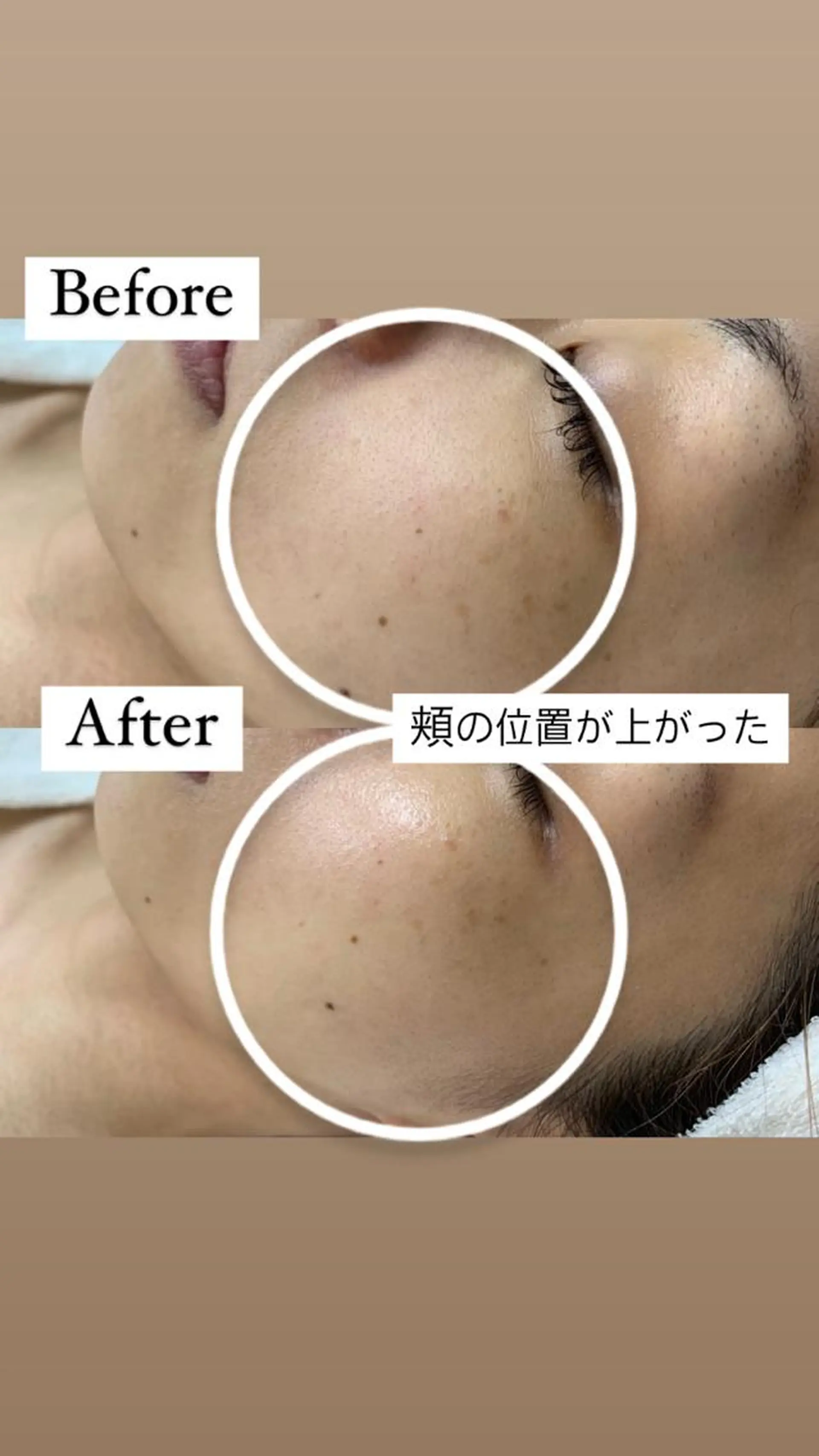 デ・アイム新潟　　北所属・山口 萌のエステ・リラクイメージ