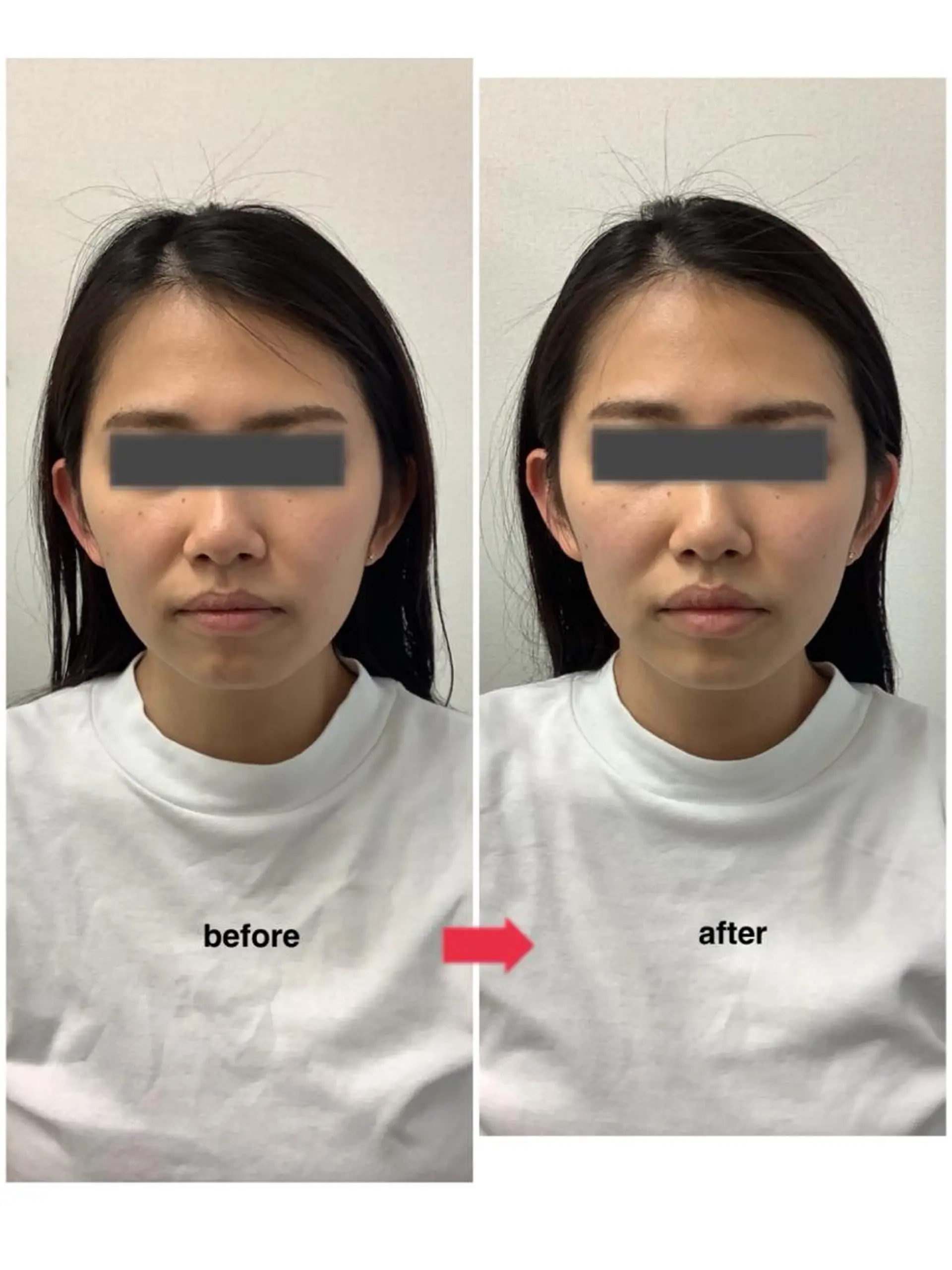 メディカルサロンドオフ所属・ハリサロンドオフ 美容鍼灸×小顔整体のエステ・リラクイメージ