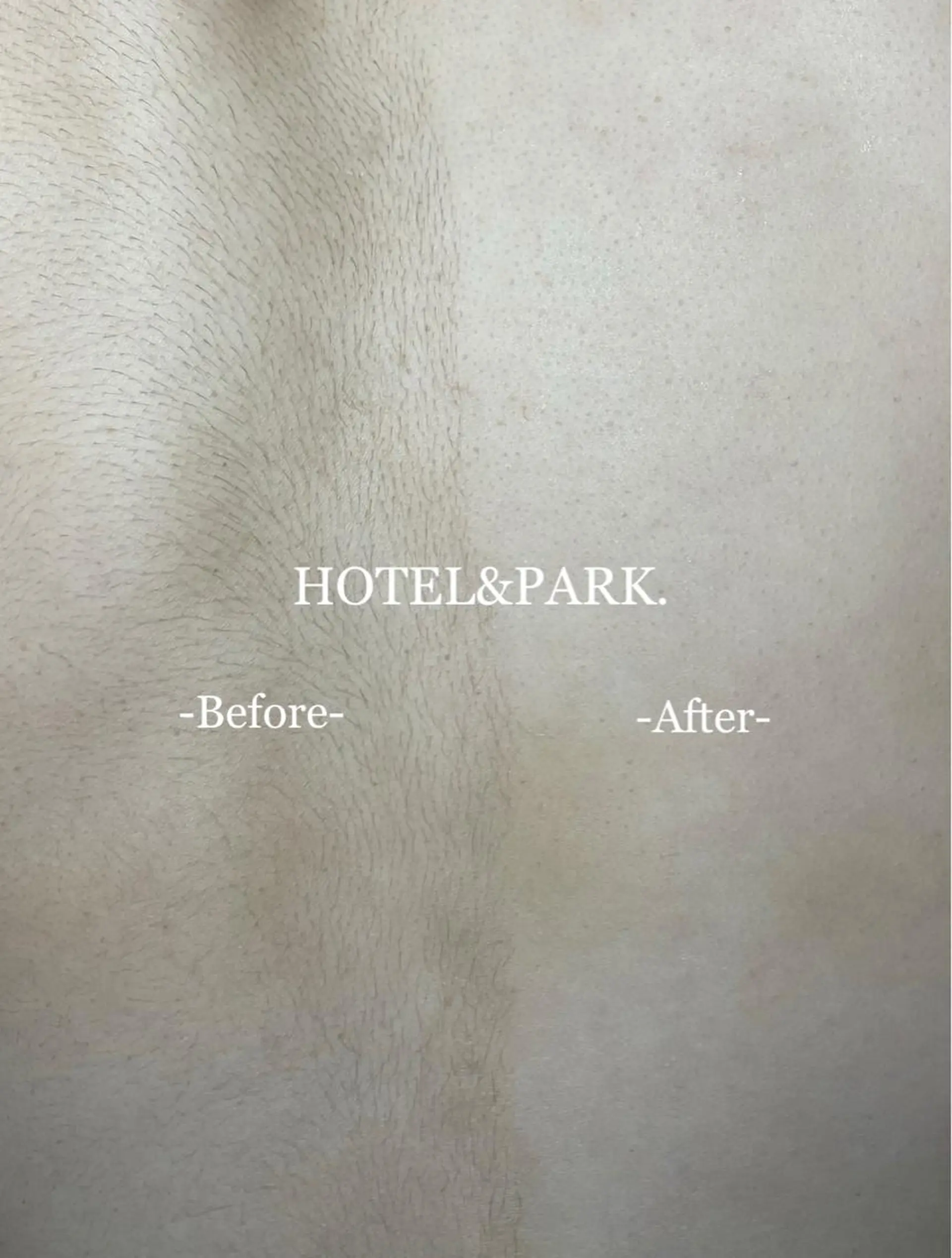 HOTEL&PARK . ワックス脱毛のエステ・リラクイメージ