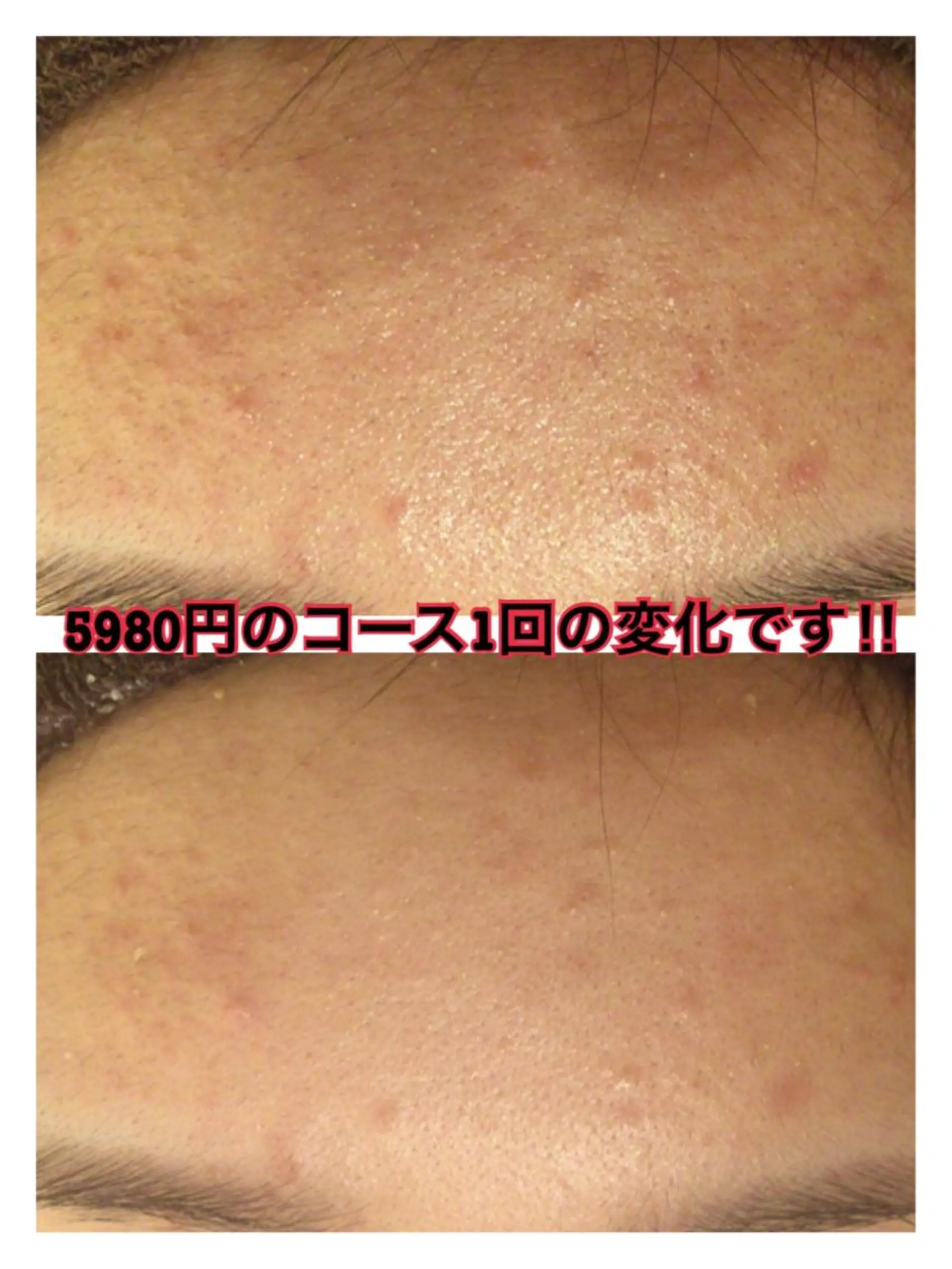 ショート カラー パーマ ヘアアレンジ メンズ キッズ ネイル マツエク・マツパ ニキビ・肌質改善専門 ♡人生が変わるサロンのエステ・リラクイメージ