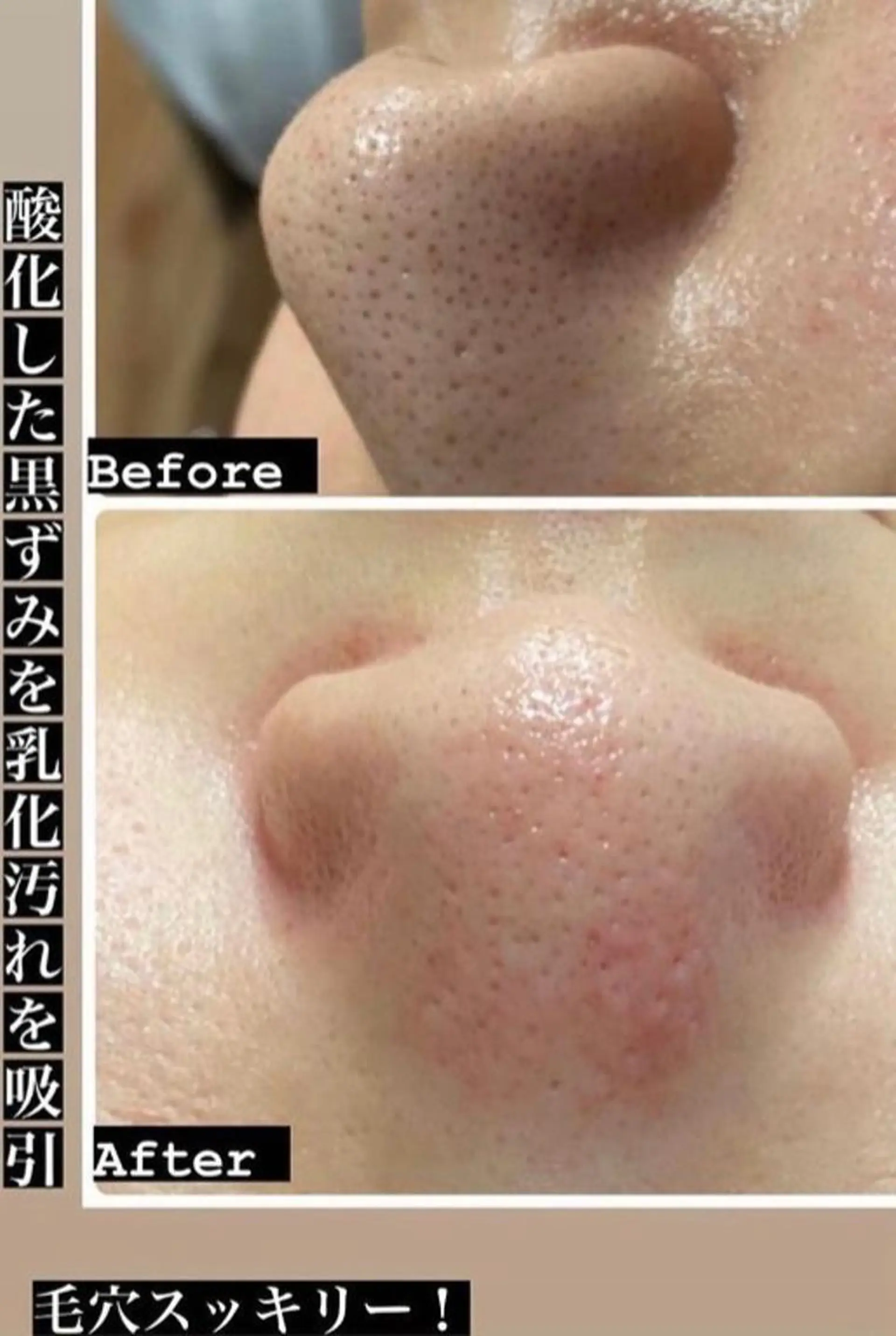 エステ 美顔秘密基地新宮所属・美顔秘密基地 新宮のその他イメージ