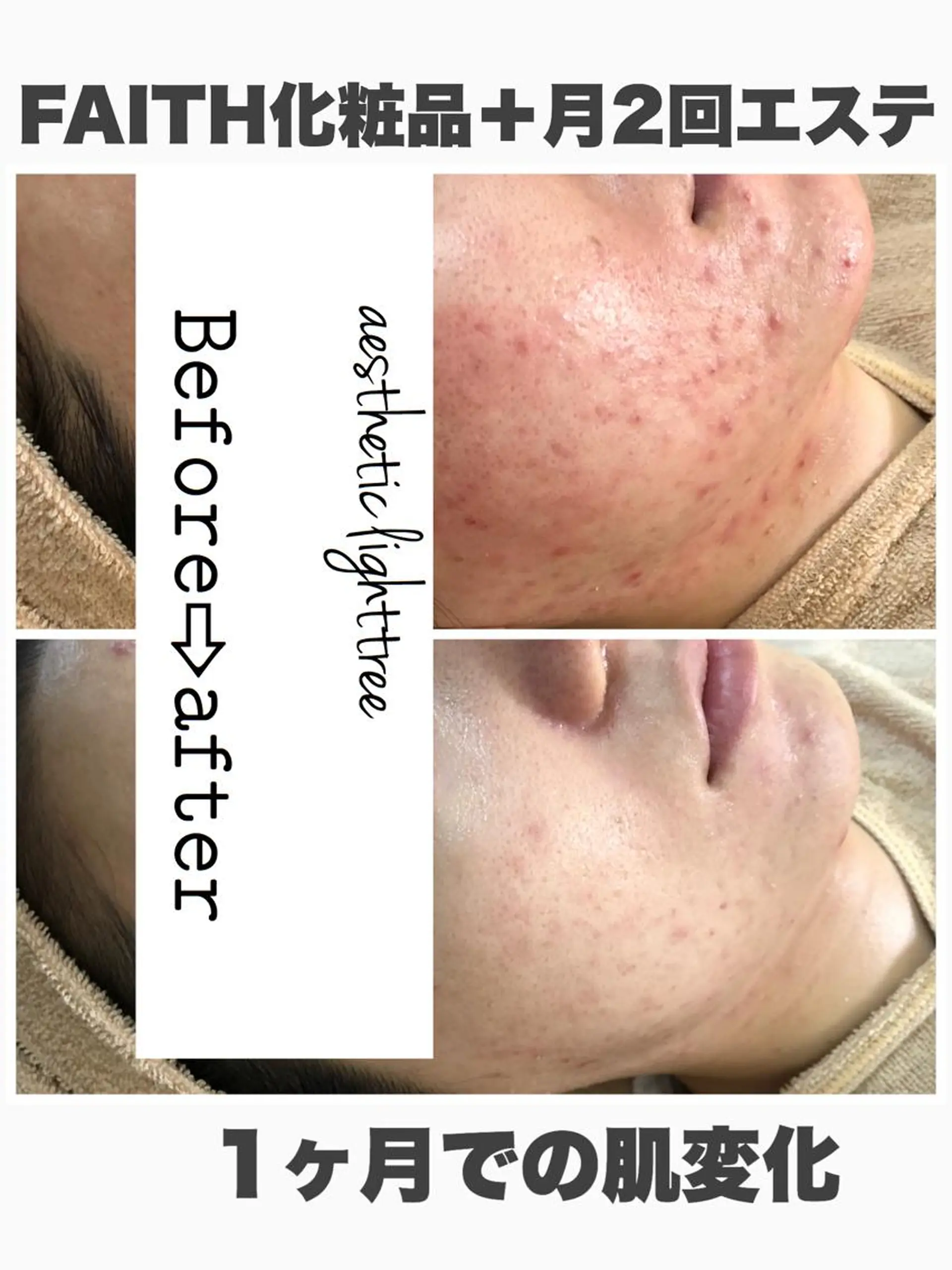 ロング カラー パーマ ヘアアレンジ メンズ キッズ ネイル マツエク・マツパ エステ ニキビ&跡改善サロン オーナー光木のエステ・リラクイメージ