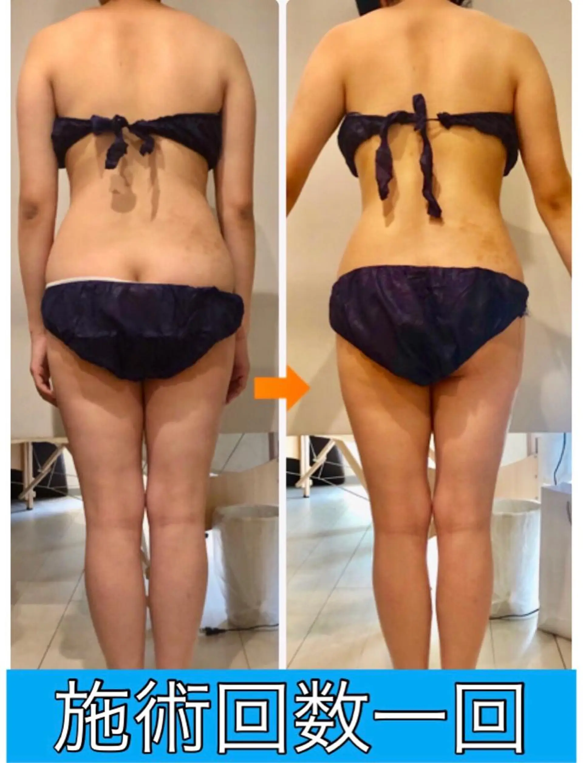 ロング カラー パーマ ヘアアレンジ メンズ キッズ ネイル マツエク・マツパ ‍痩身＆ボディ 結果出し🌟丹野のエステ・リラクイメージ