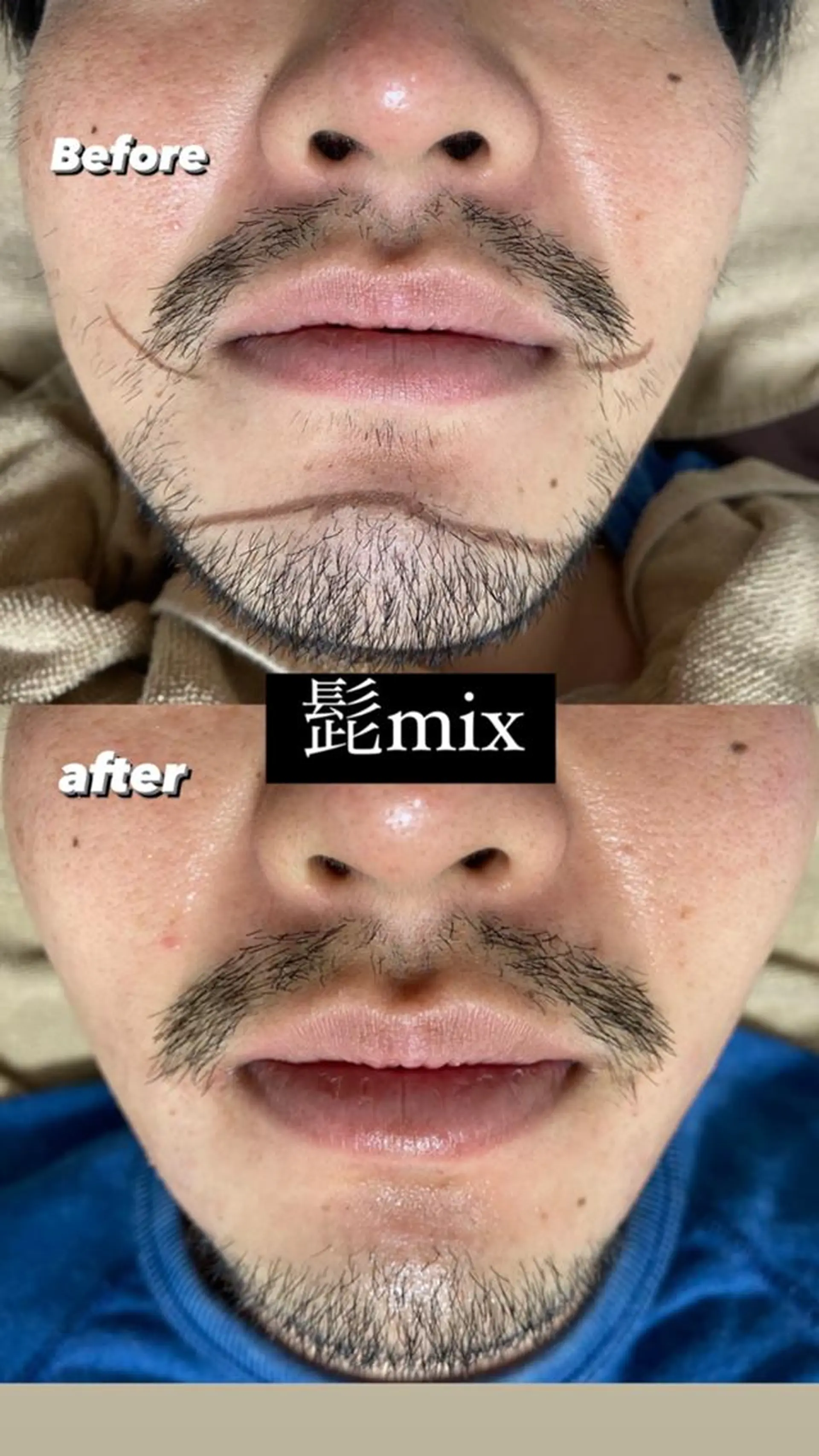 メンズ 脱毛 Epina 千葉店 【エピナ】のエステ・リラクイメージ