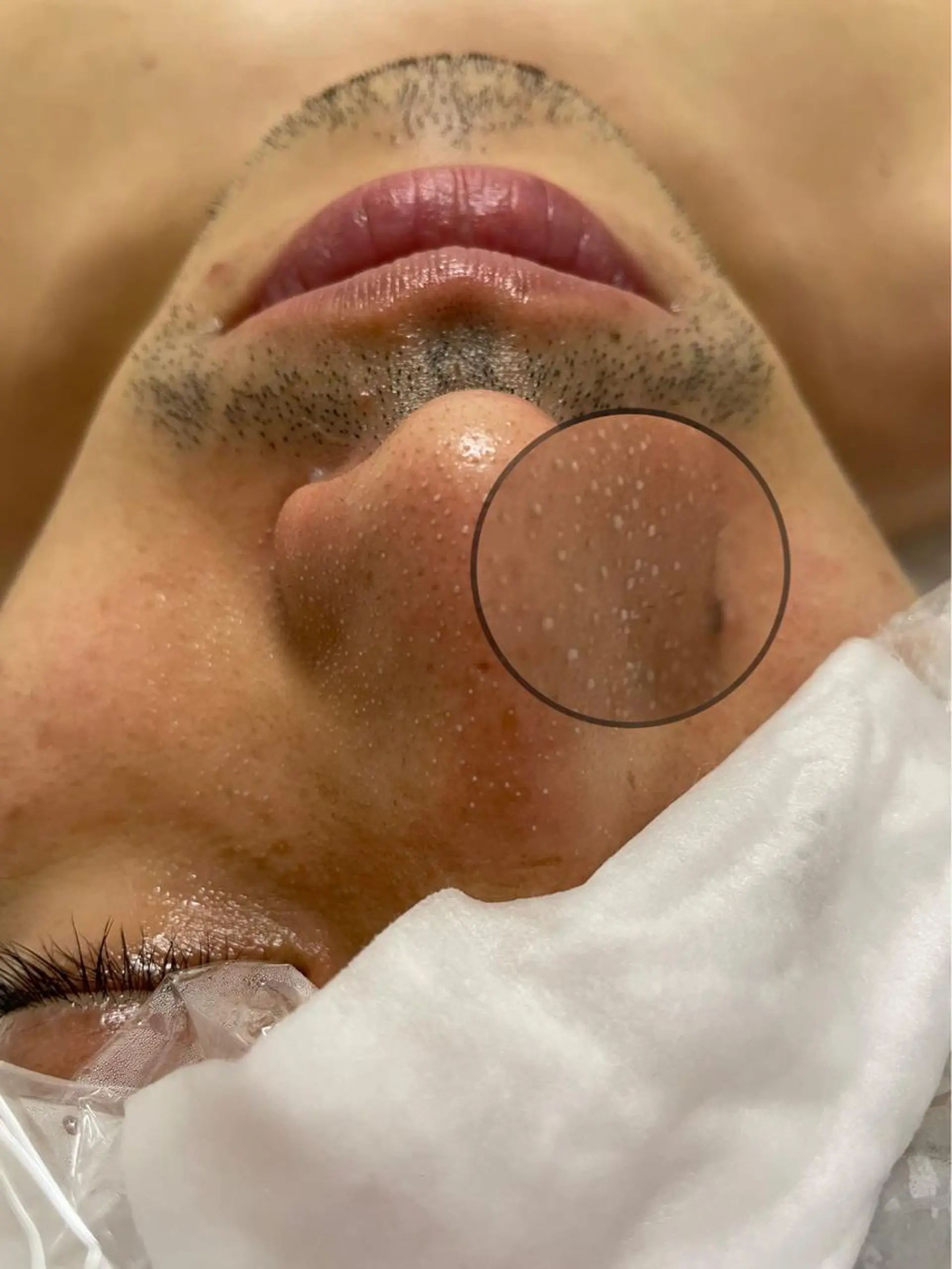 メンズ アイブロウ Amm所属・🏆艶肌ワックス🏆 ララピール✨Ammのエステ・リラクイメージ