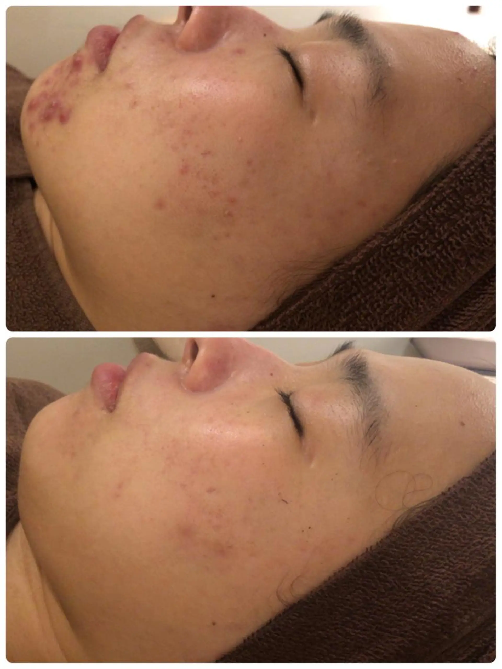 ミディアム カラー パーマ ヘアアレンジ メンズ キッズ ネイル マツエク・マツパ エステ リラク ニキビ・肌質改善専門 ♡人生が変わるサロンのエステ・リラクイメージ