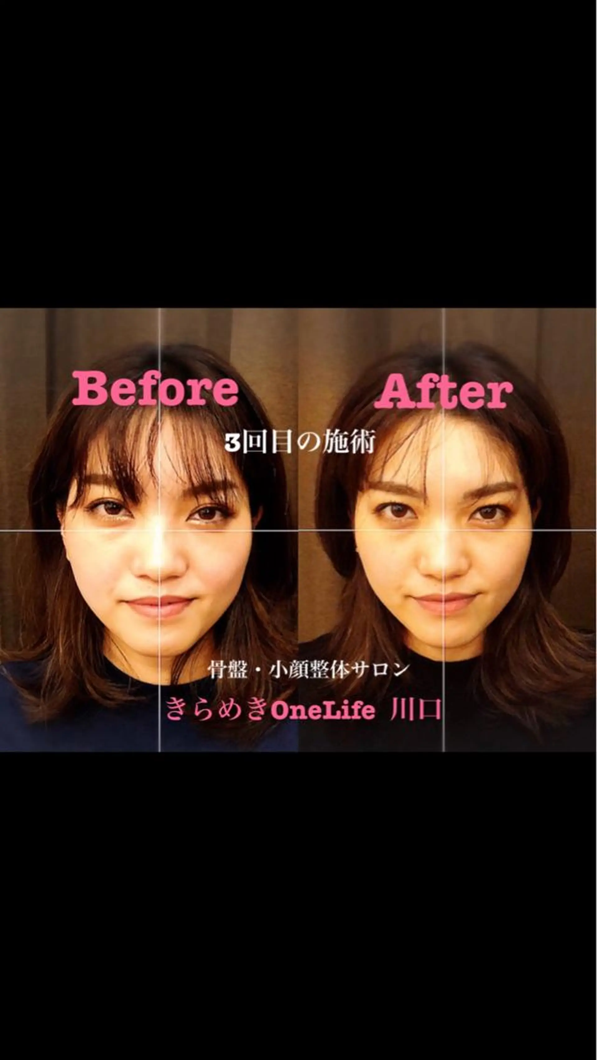 エステ リラク きらめきワンライフ Yumaのエステ・リラクイメージ