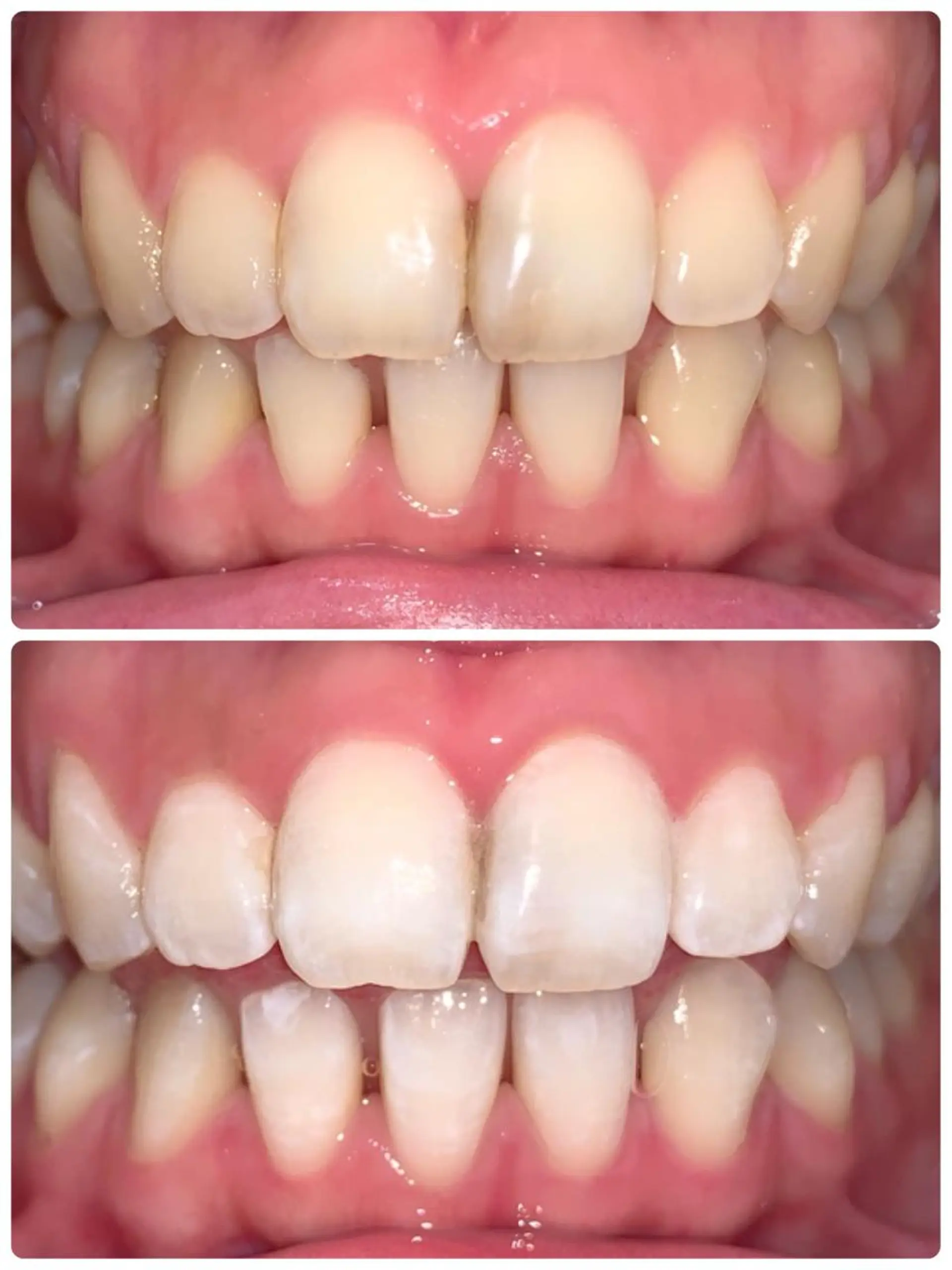 LOVE ホワイトニング渋谷のその他イメージ