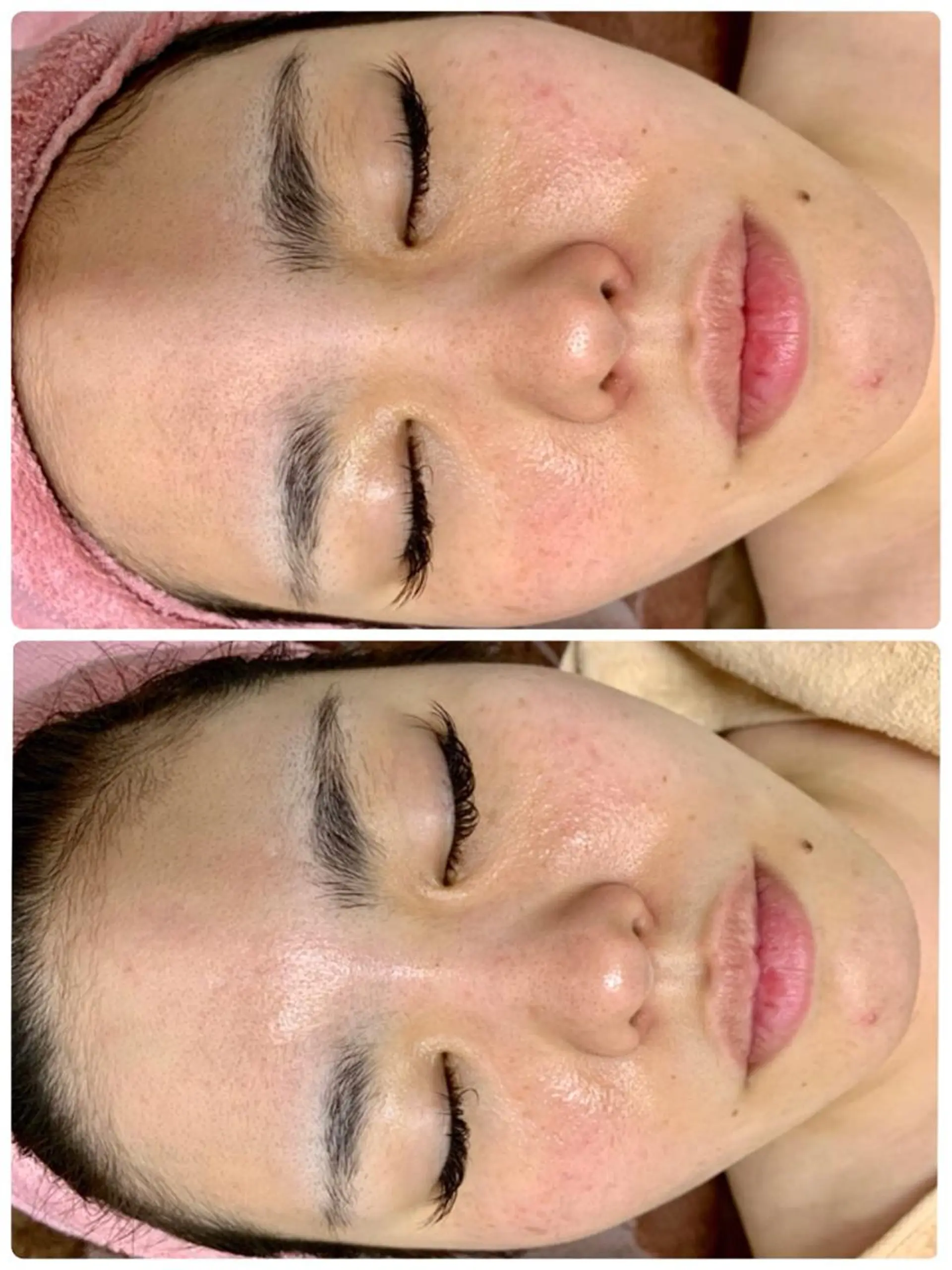 ハーブピーリングMB eautySalonのエステ・リラクイメージ