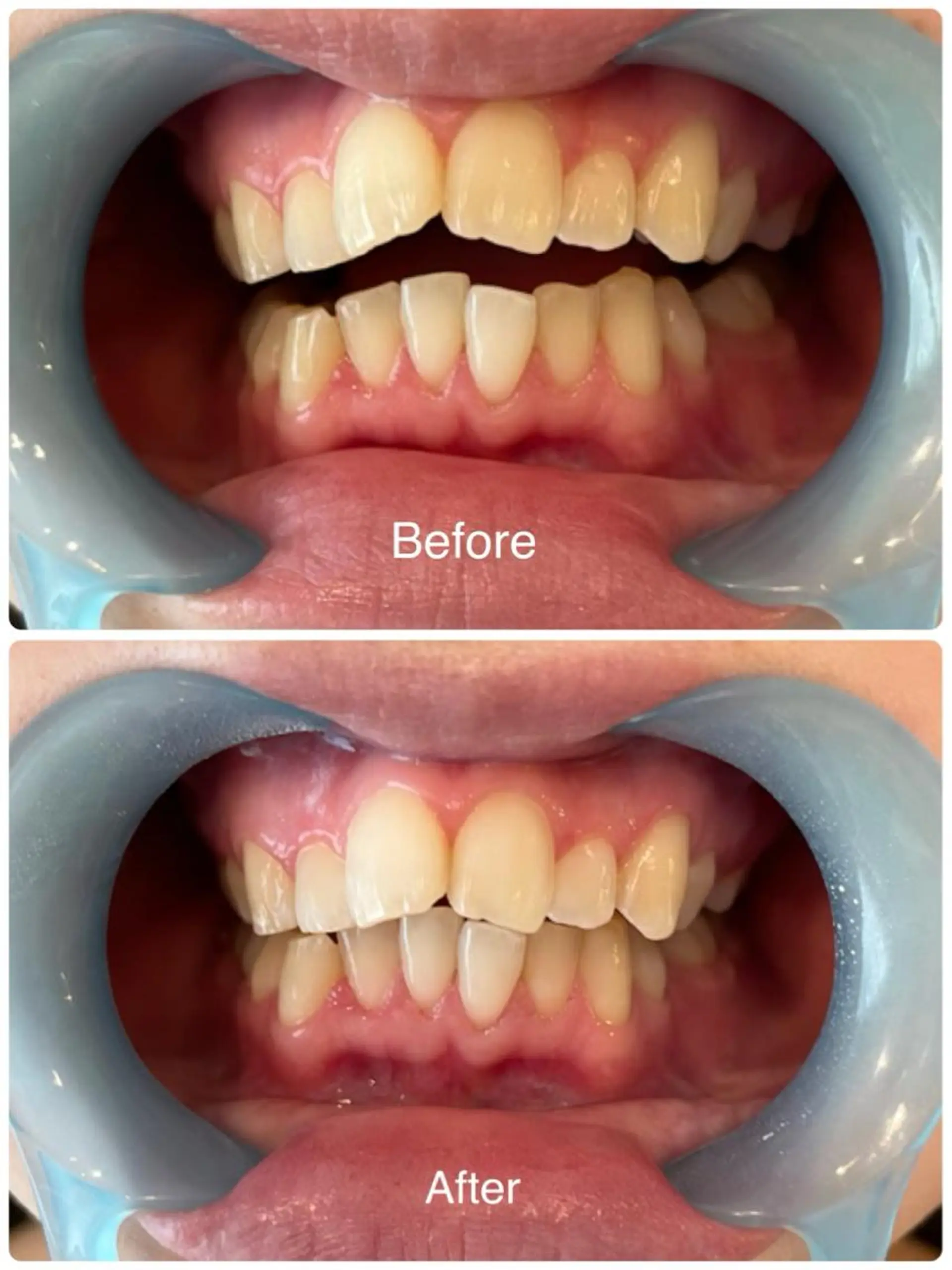 その他 Lunenail所属・Lune nailのネイルデザイン