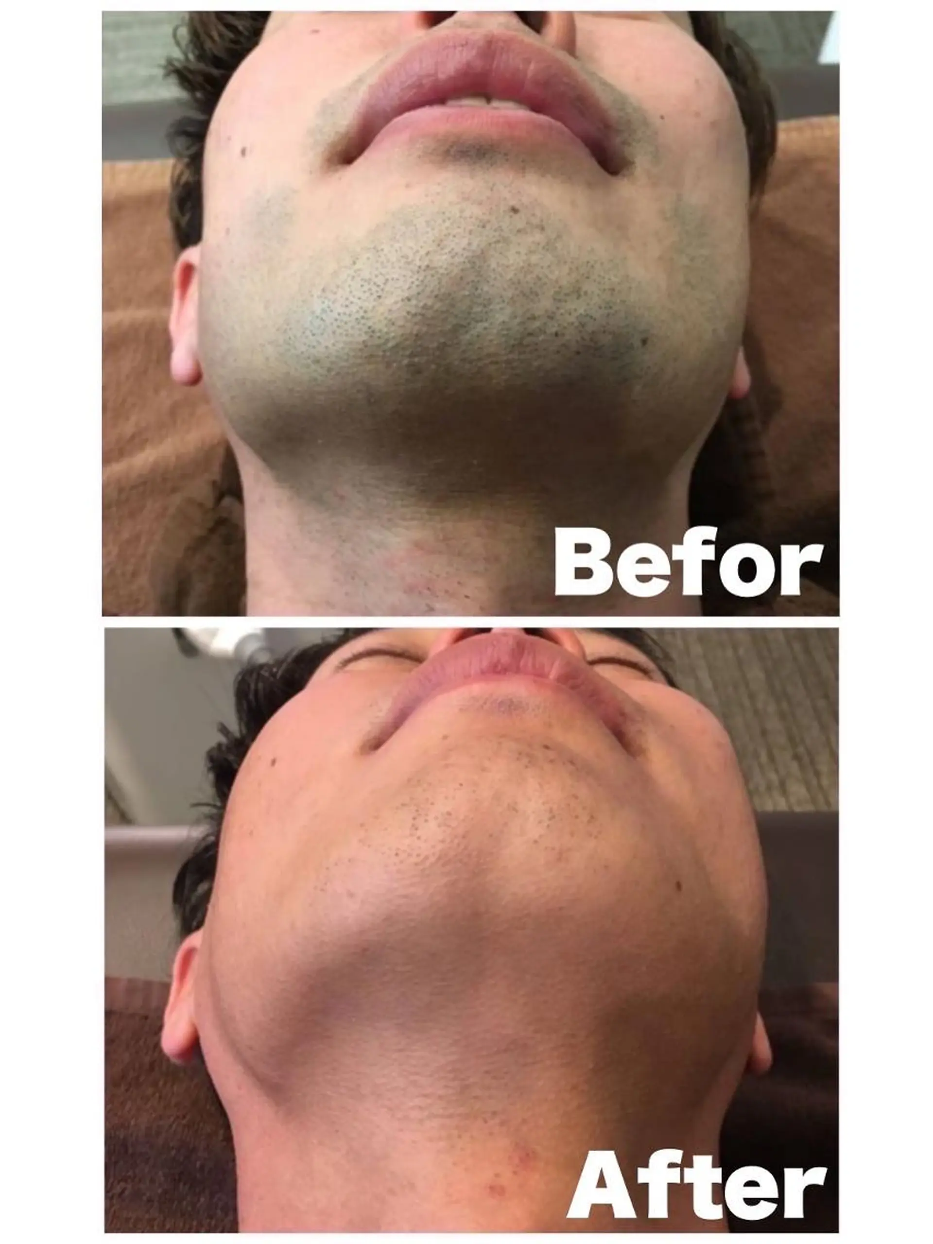 メンズ レグルスゼロ 甲府店のエステ・リラクイメージ