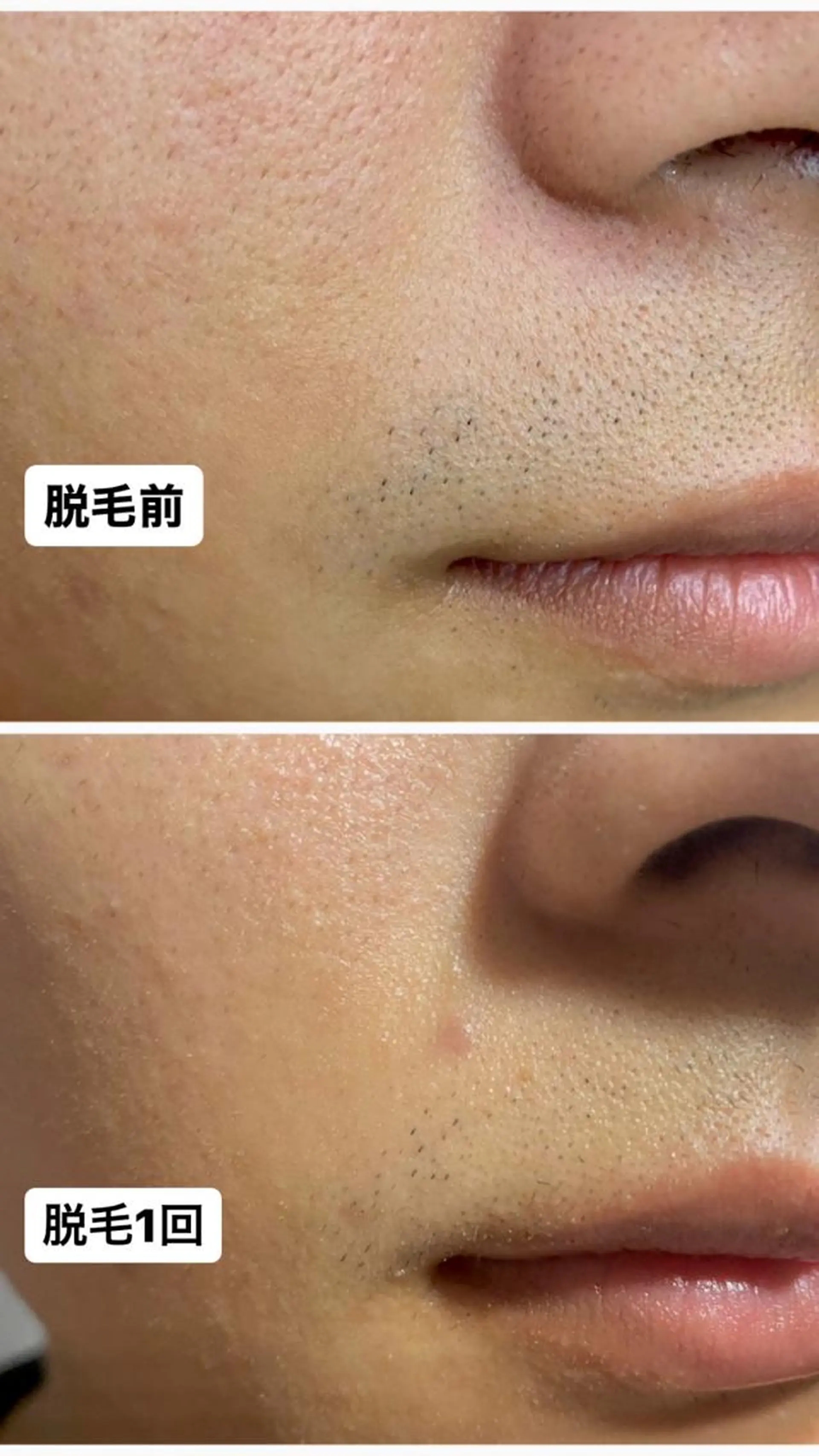 脱毛 脱毛・エステサロン LuLuNのエステ・リラクイメージ