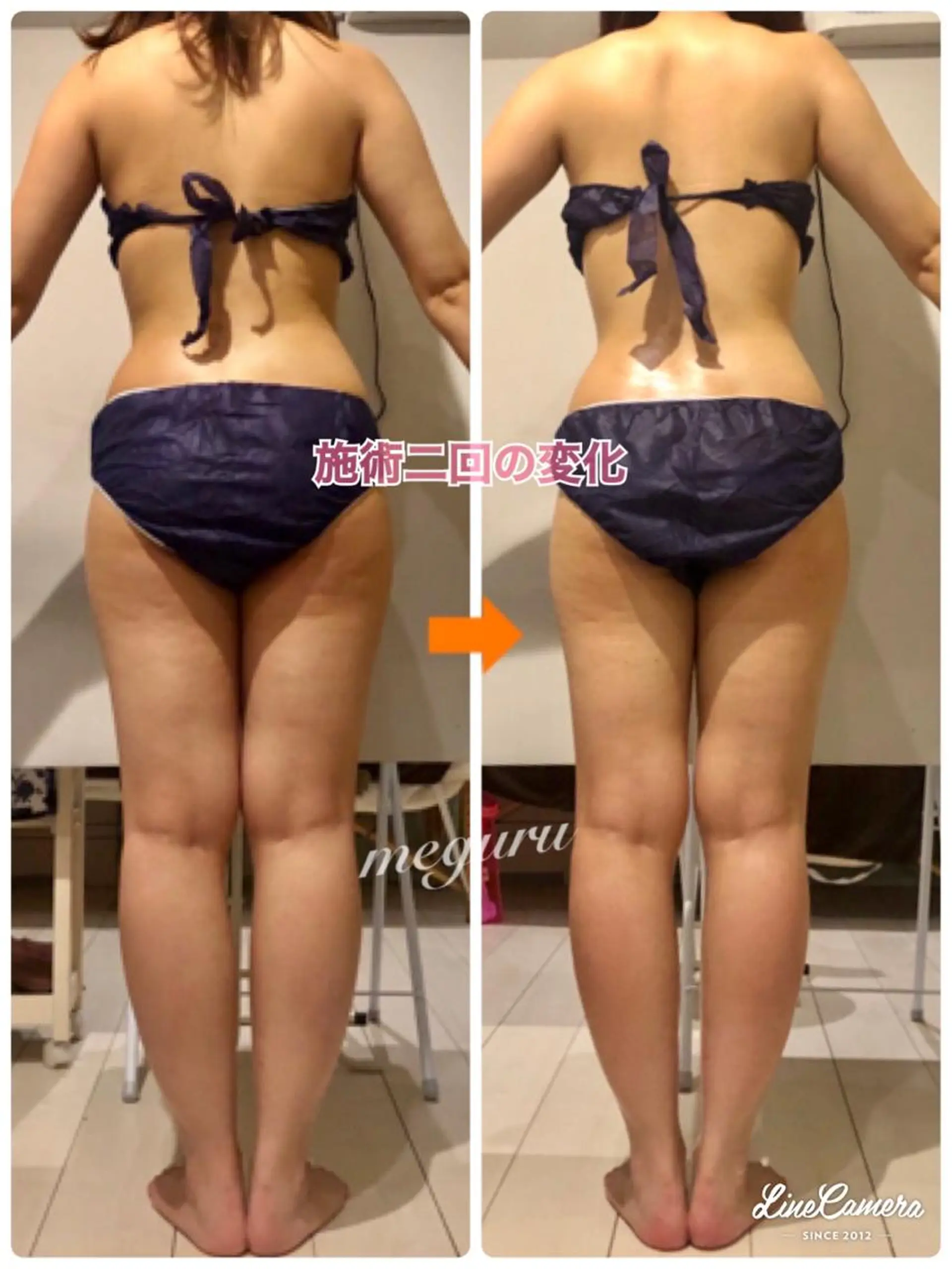 ショート カラー パーマ ヘアアレンジ メンズ キッズ ネイル マツエク・マツパ エステ リラク ‍痩身＆ボディ 結果出し🌟丹野のエステ・リラクイメージ