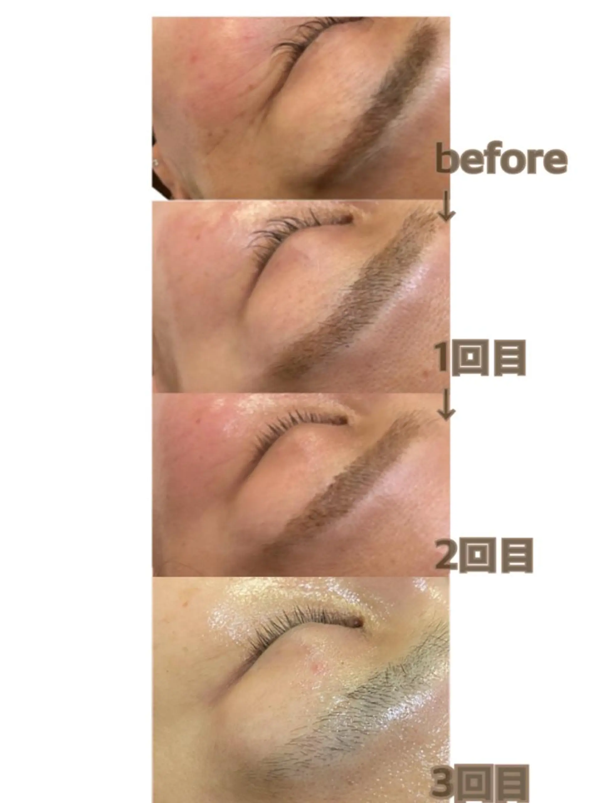 aroma  YURARI所属・韓国艶美人// 毛穴ケア🌹のエステ・リラクイメージ