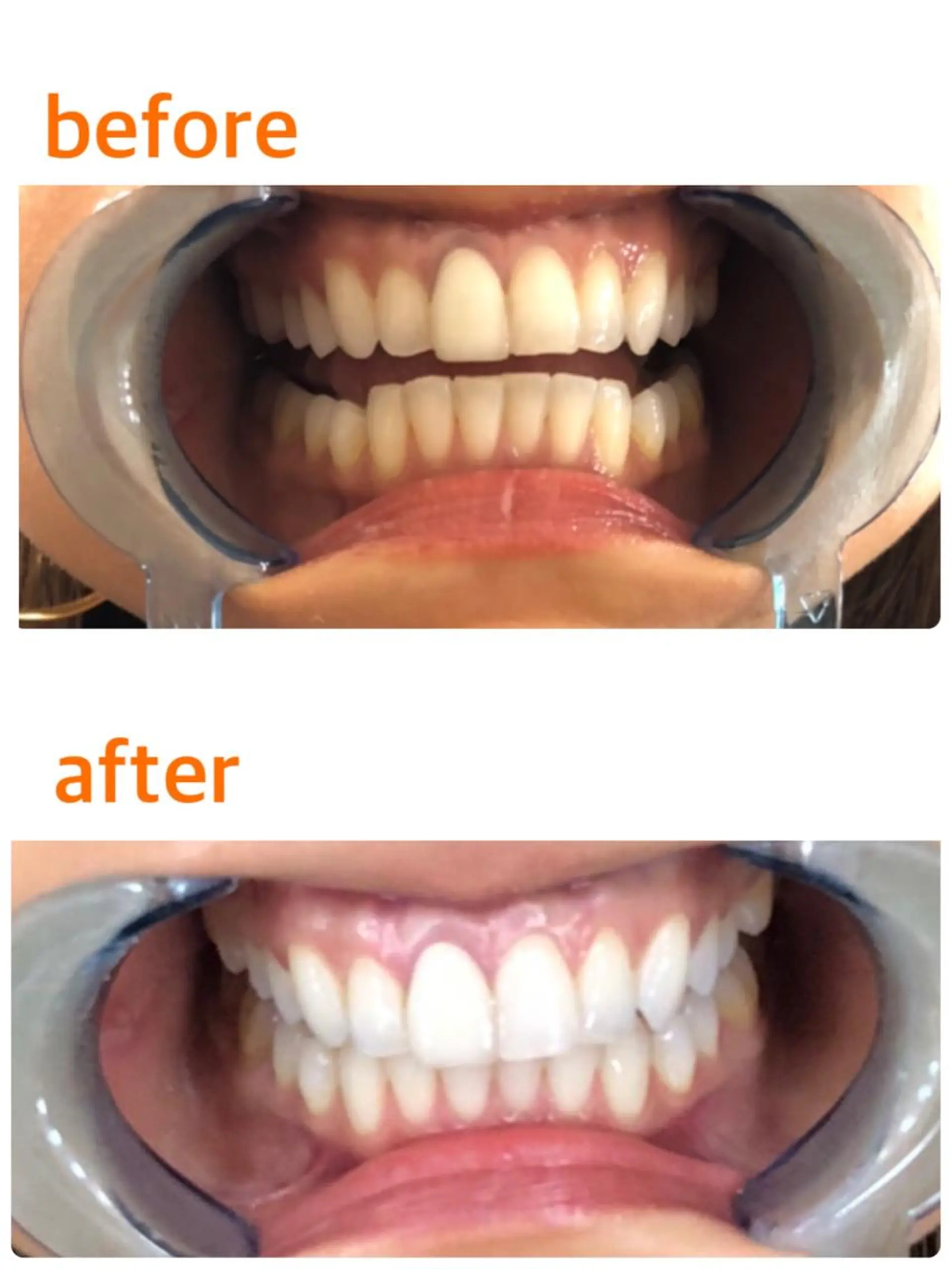 クリスタルラウンジ銀座店所属・クリスタルラウンジ ホワイトニング銀座店のエステ・リラクイメージ