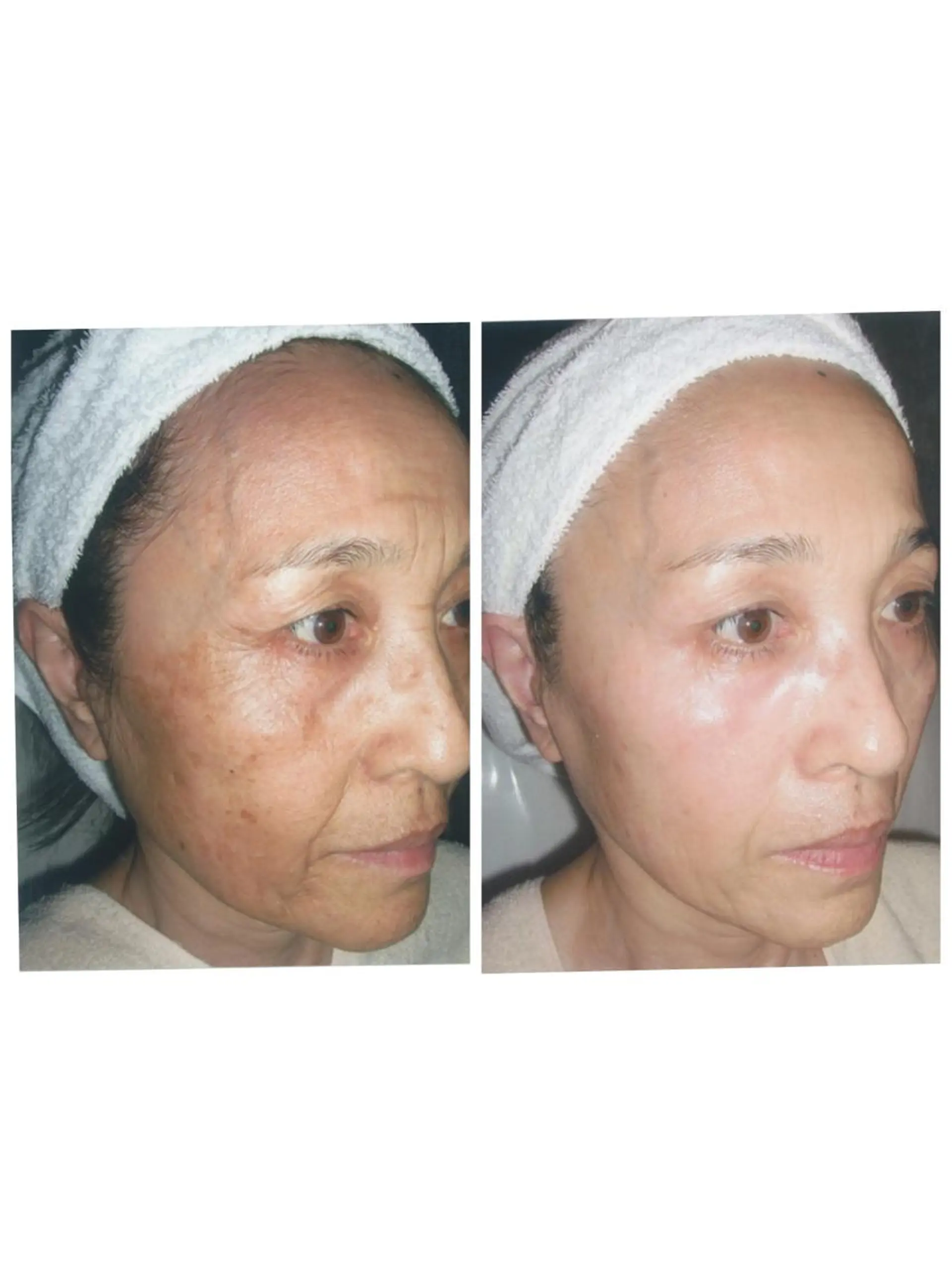 マドンナ 富士店のエステ・リラクイメージ