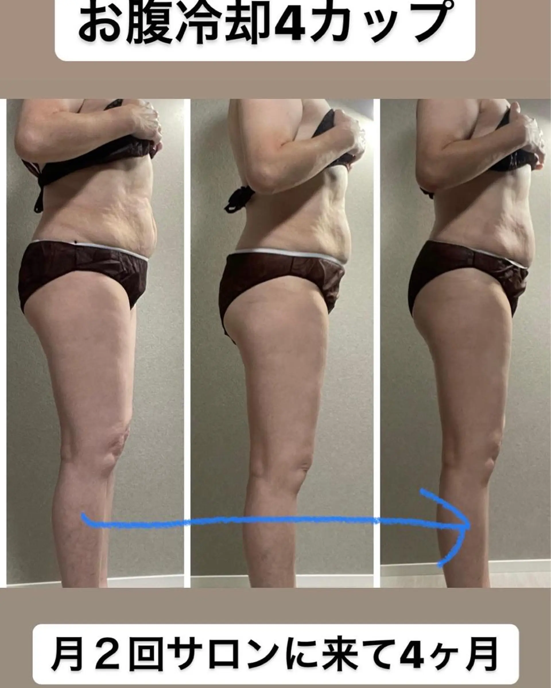 エステ エステ／ネイル/脱毛 R.Msalonのネイルデザイン