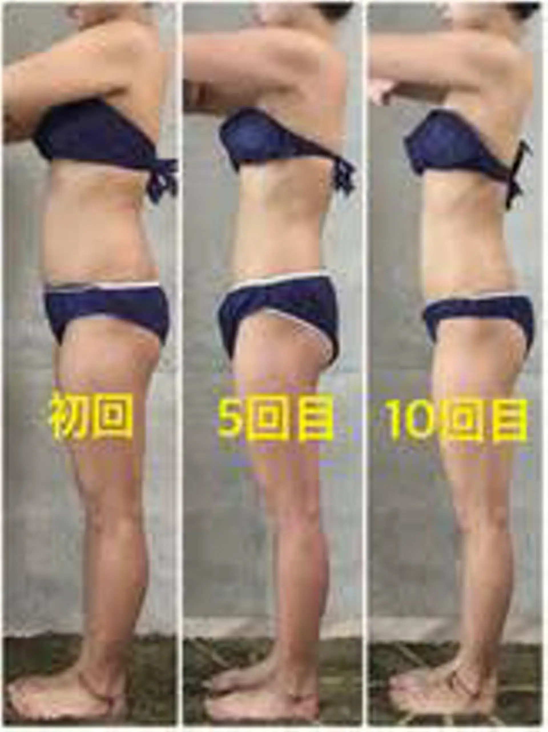 エステ BeautySalonSoin所属・【医療提携エステ】 痩身専門Soinのエステ・リラクイメージ