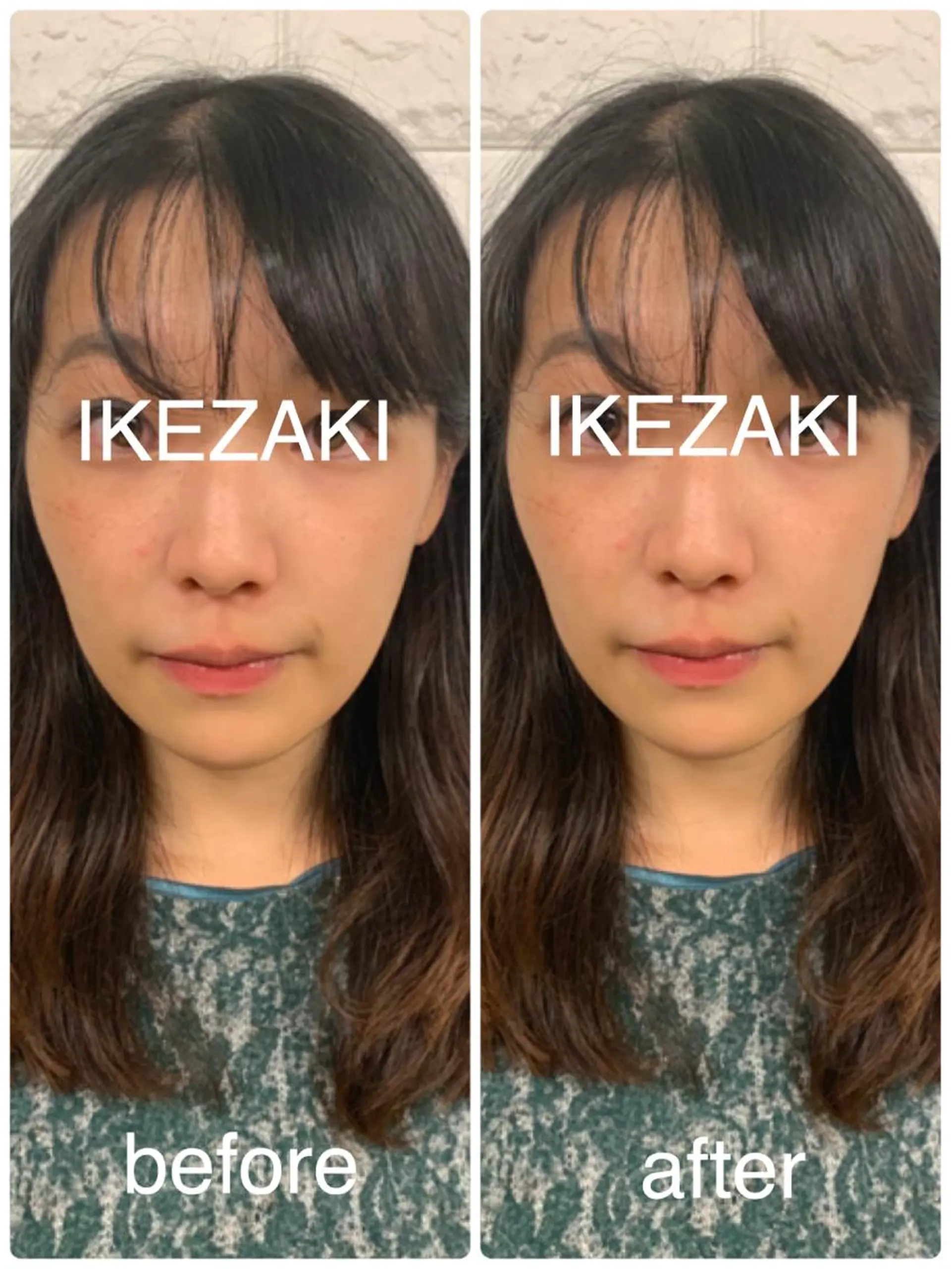 美容鍼 IKEZAKIのエステ・リラクイメージ