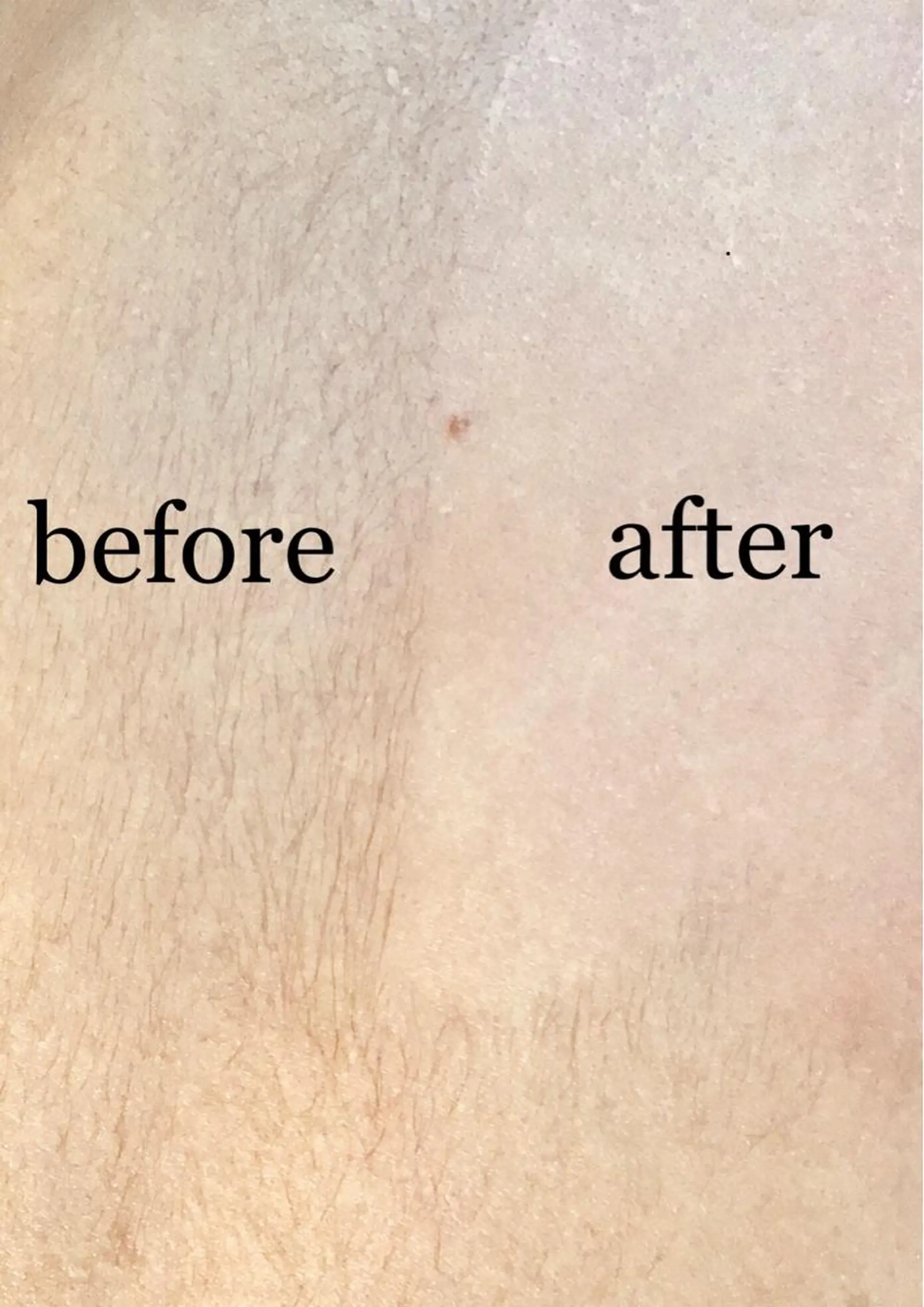 脱毛 Laugh ラフのその他イメージ