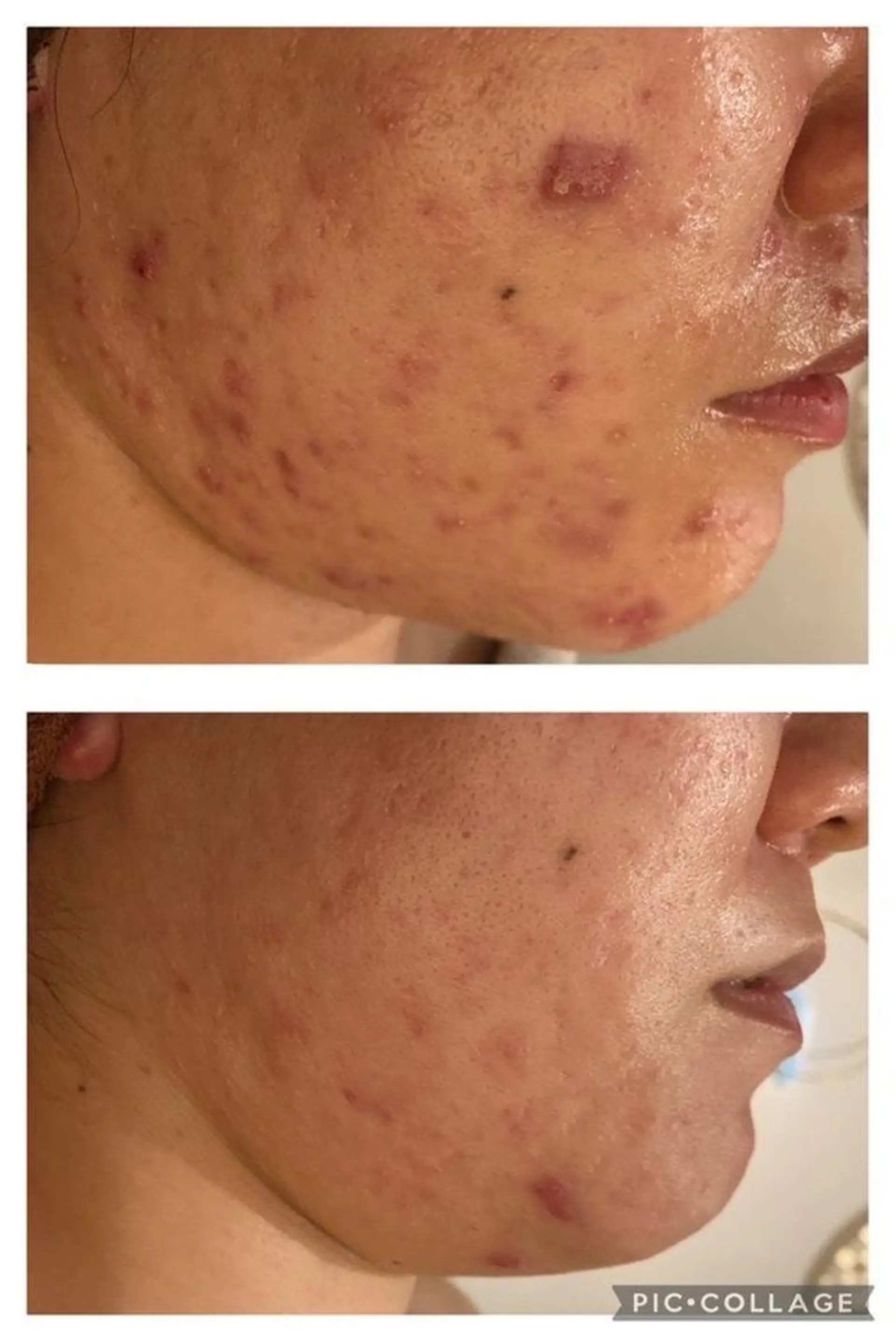 セミロング カラー パーマ ヘアアレンジ メンズ キッズ ネイル マツエク・マツパ アイブロウ エステ リラク ニキビ特化型エステ 🍓最短で肌質改善のエステ・リラクイメージ