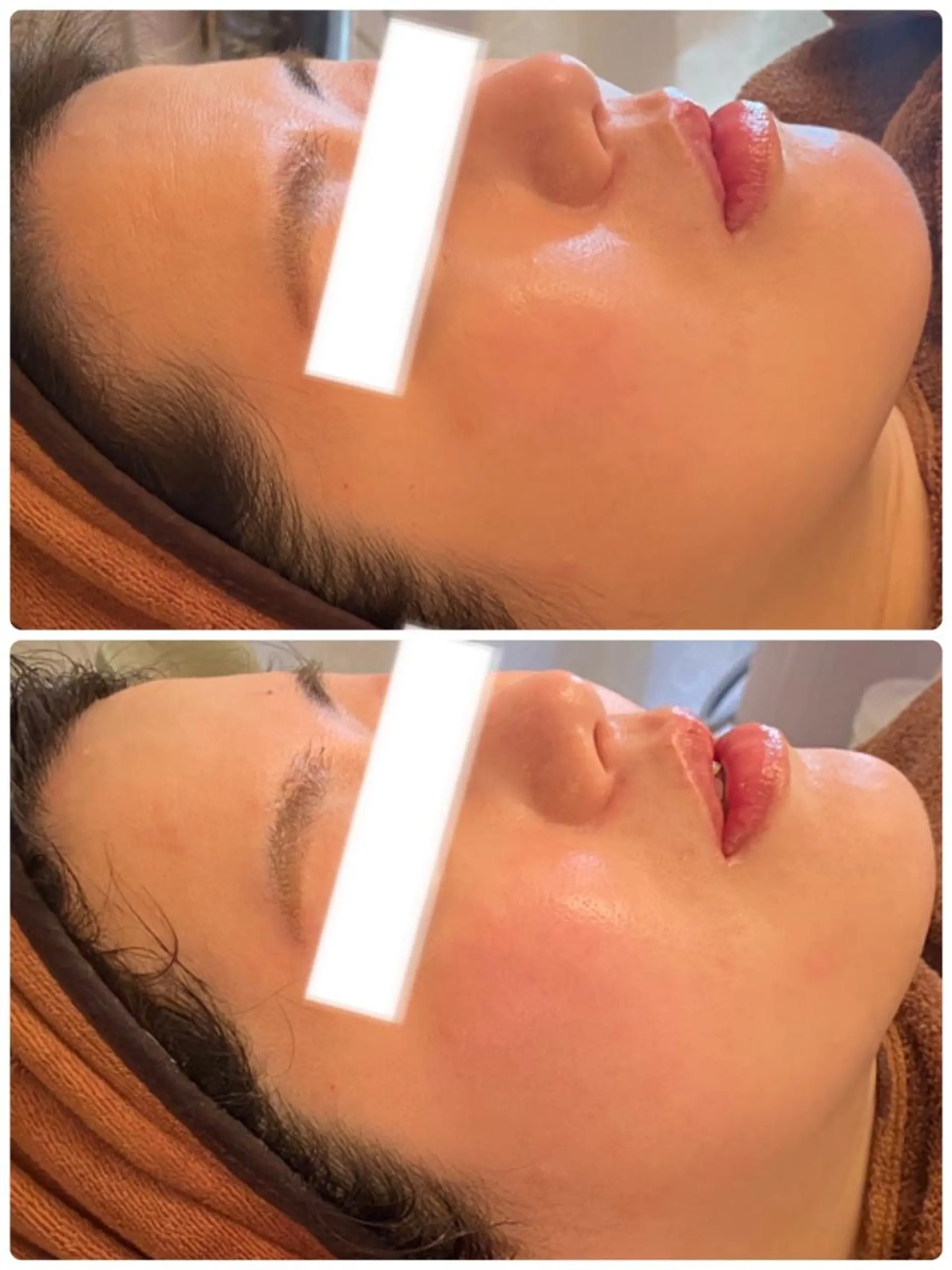 FLEUR大阪・美容 整体・痩身・小顔のエステ・リラクイメージ