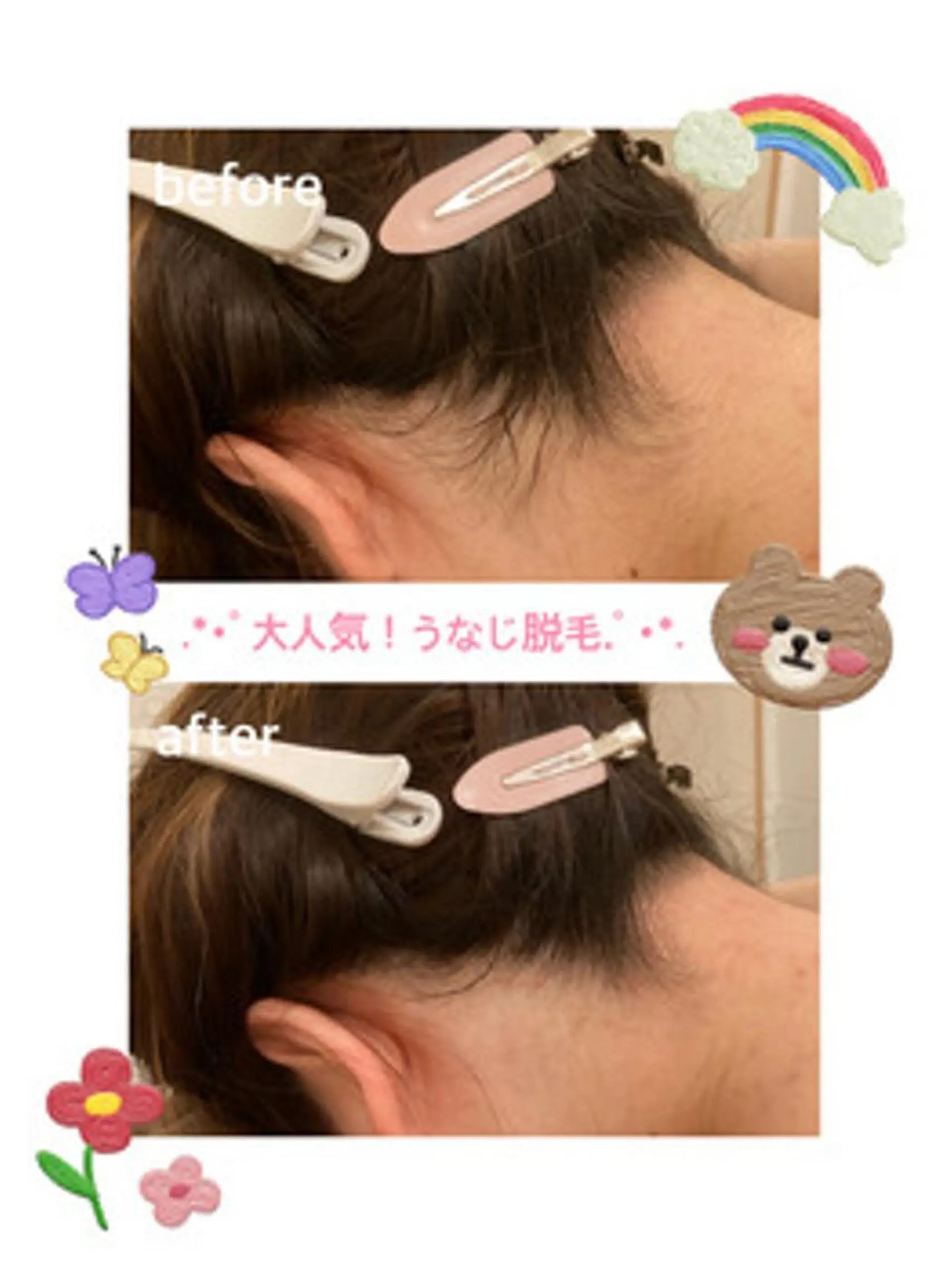 メンズ 都度払い脱毛⭐️ 脱毛サロンMIRACのエステ・リラクイメージ