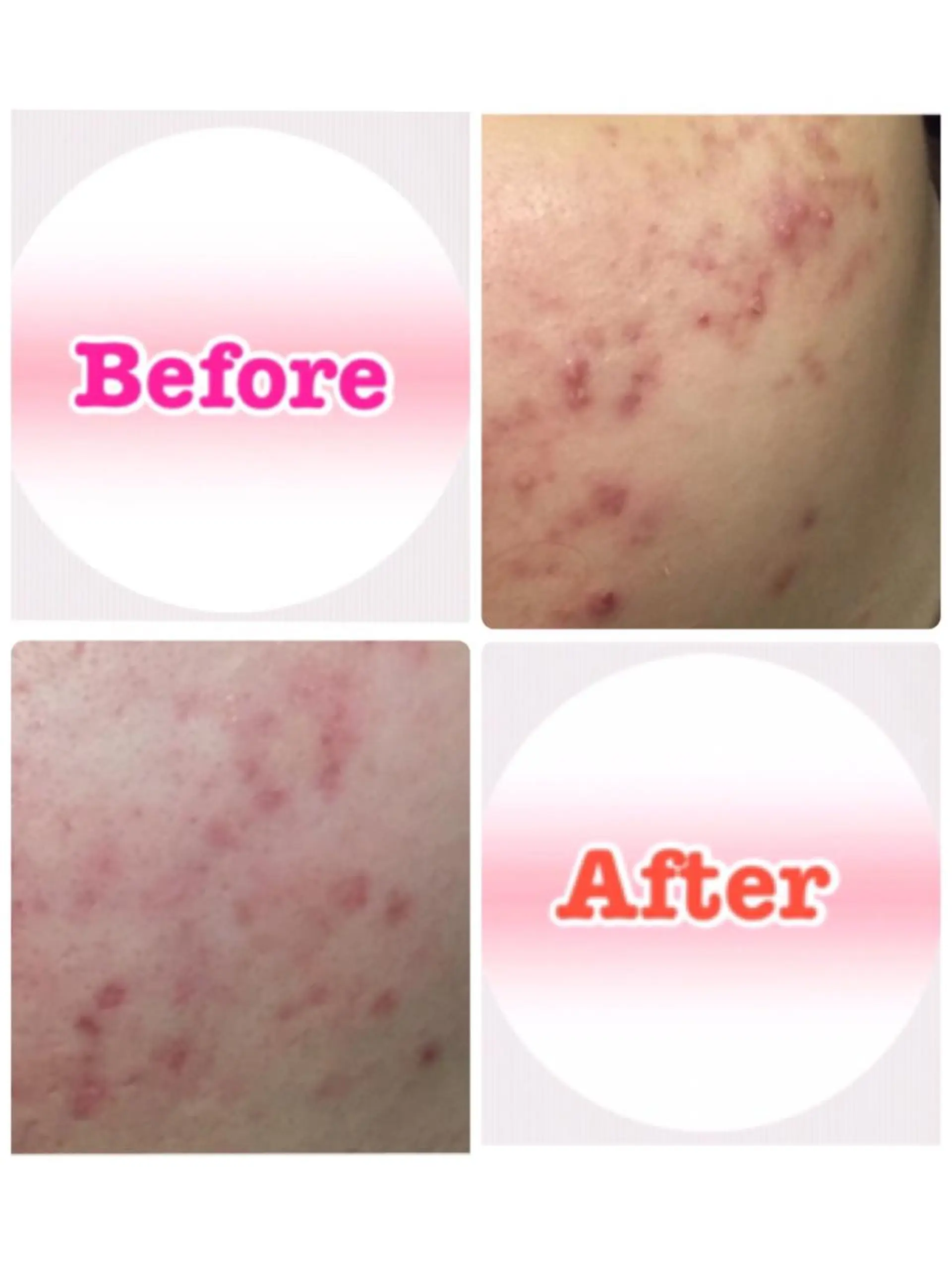 ロング カラー パーマ ヘアアレンジ メンズ キッズ ネイル マツエク・マツパ フットネイル マットネイル ‍痩身＆ボディ 結果出し🌟丹野のエステ・リラクイメージ