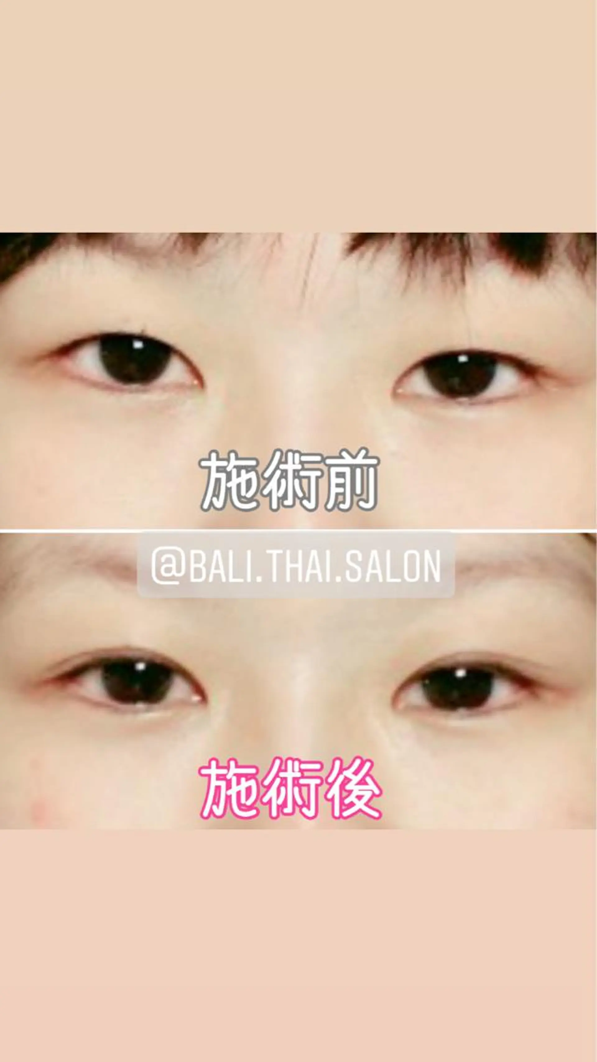 🌈歪み改善🌈 バリンタイ すぎうらのエステ・リラクイメージ