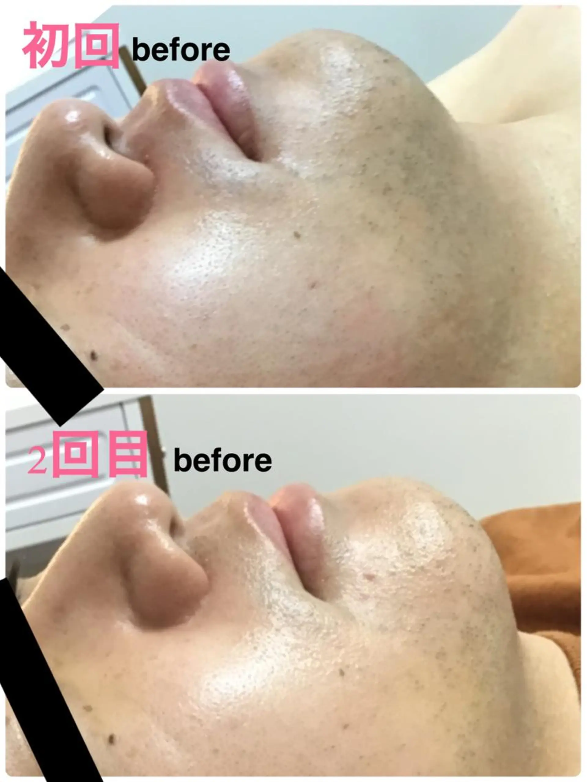 メンズ 脱毛 BELLEFINE 💕痩身・小顔・脱毛のエステ・リラクイメージ