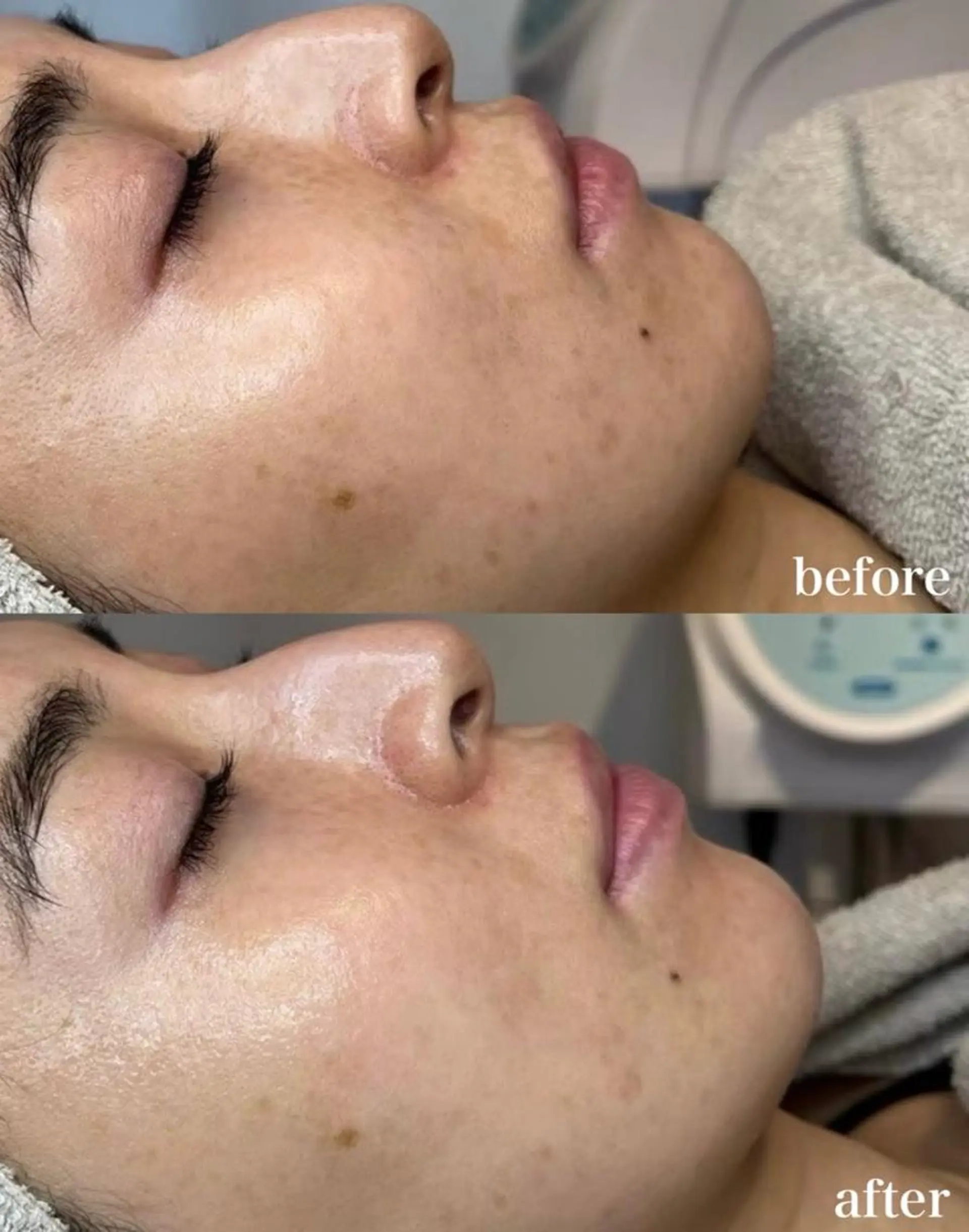 エステ 小林 理恵のエステ・リラクイメージ